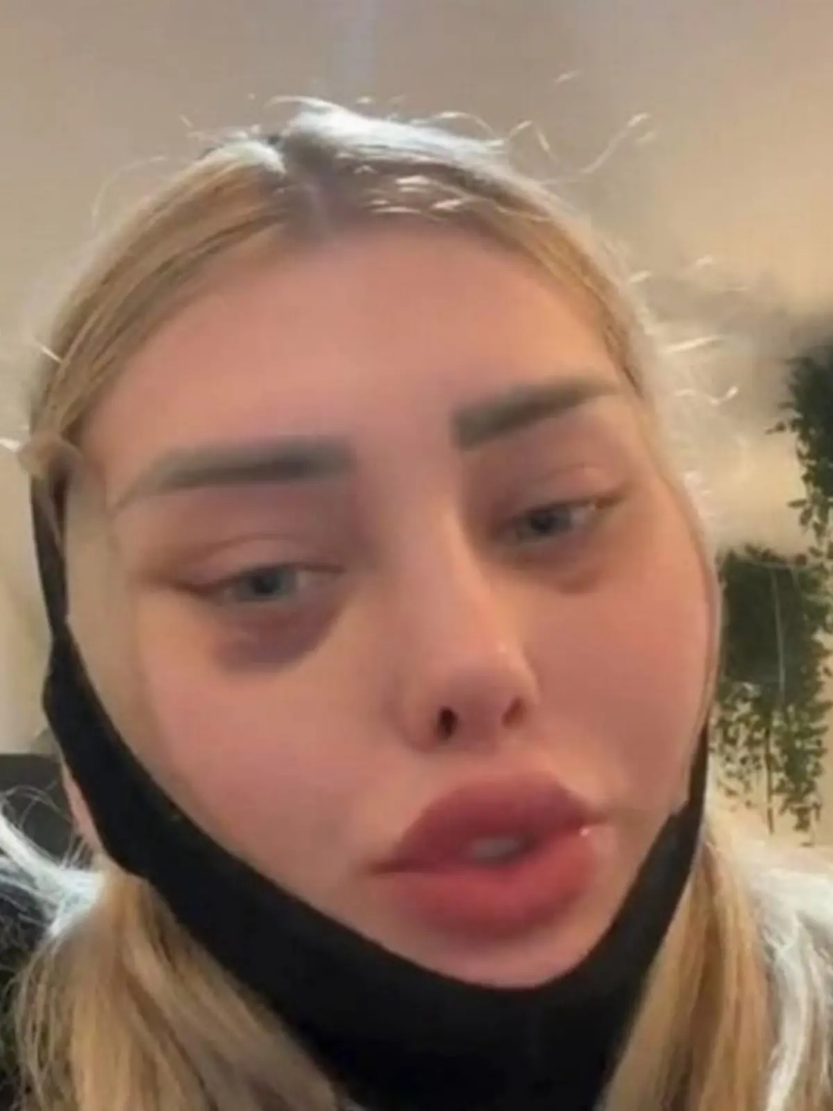 TikTok-Userin Weronika erzählt, wie ihr Kopf an Bord eines Flugzeugs "explodierte".