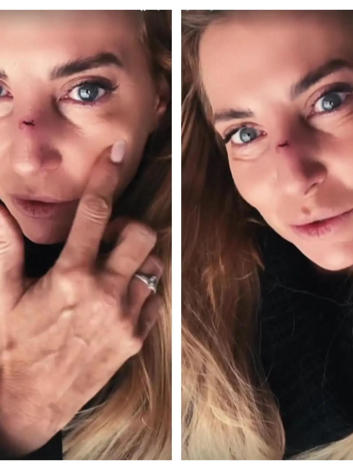 Giulia Siegel zeigt bei Instagram das Ergebnis von ihrer schmerzhaften Begegnung mit einer Glastüre.