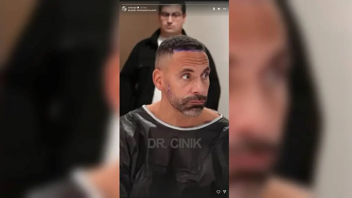 Rio Ferdinand steht zu seiner Haar- und Barttransplantation.