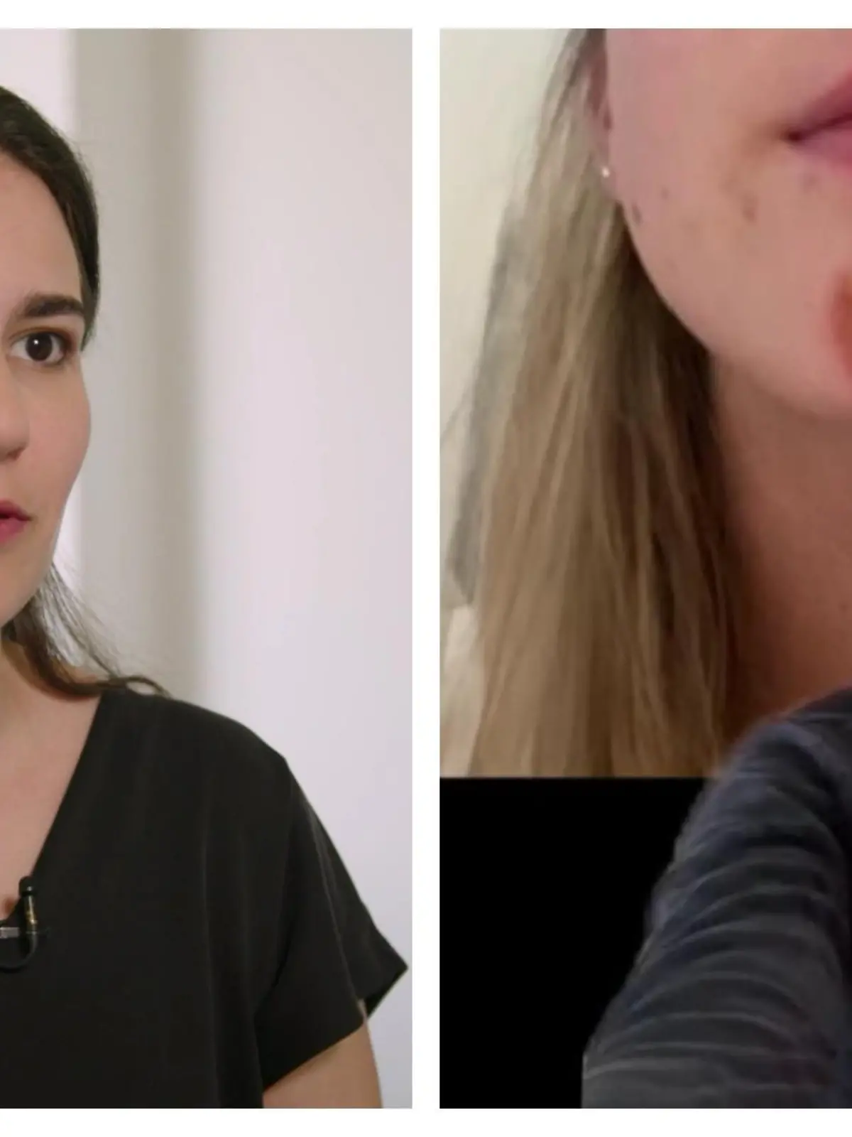 Dr. Alice Martin (links) erklärt, was hinter dem fiesen Ekzem am Kinn einer TikTok-Nutzerin steckt.