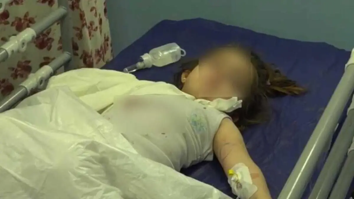 A girl lies on a hospital bed in Sulaymaniyah, Iraq, in an undated photo.  She was reportedly attacked by a bear in a zoo. (Newsflash)