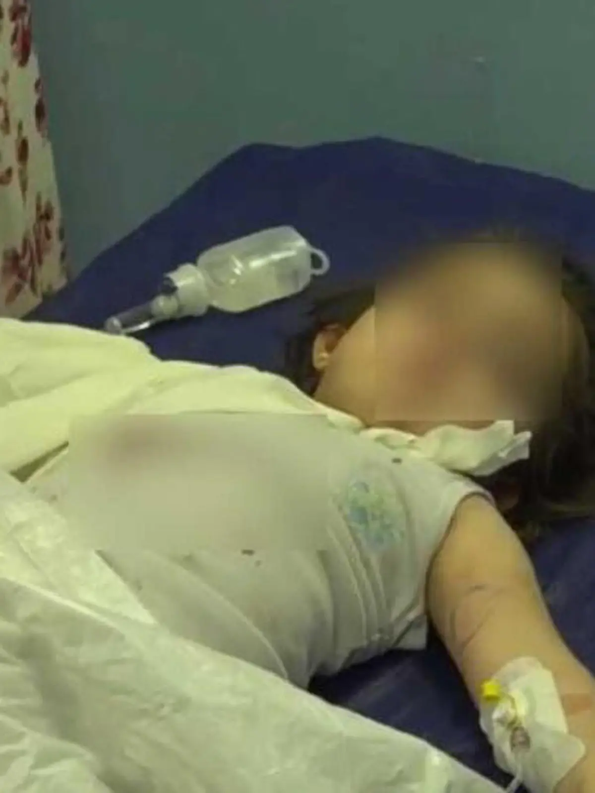 A girl lies on a hospital bed in Sulaymaniyah, Iraq, in an undated photo.  She was reportedly attacked by a bear in a zoo. (Newsflash)