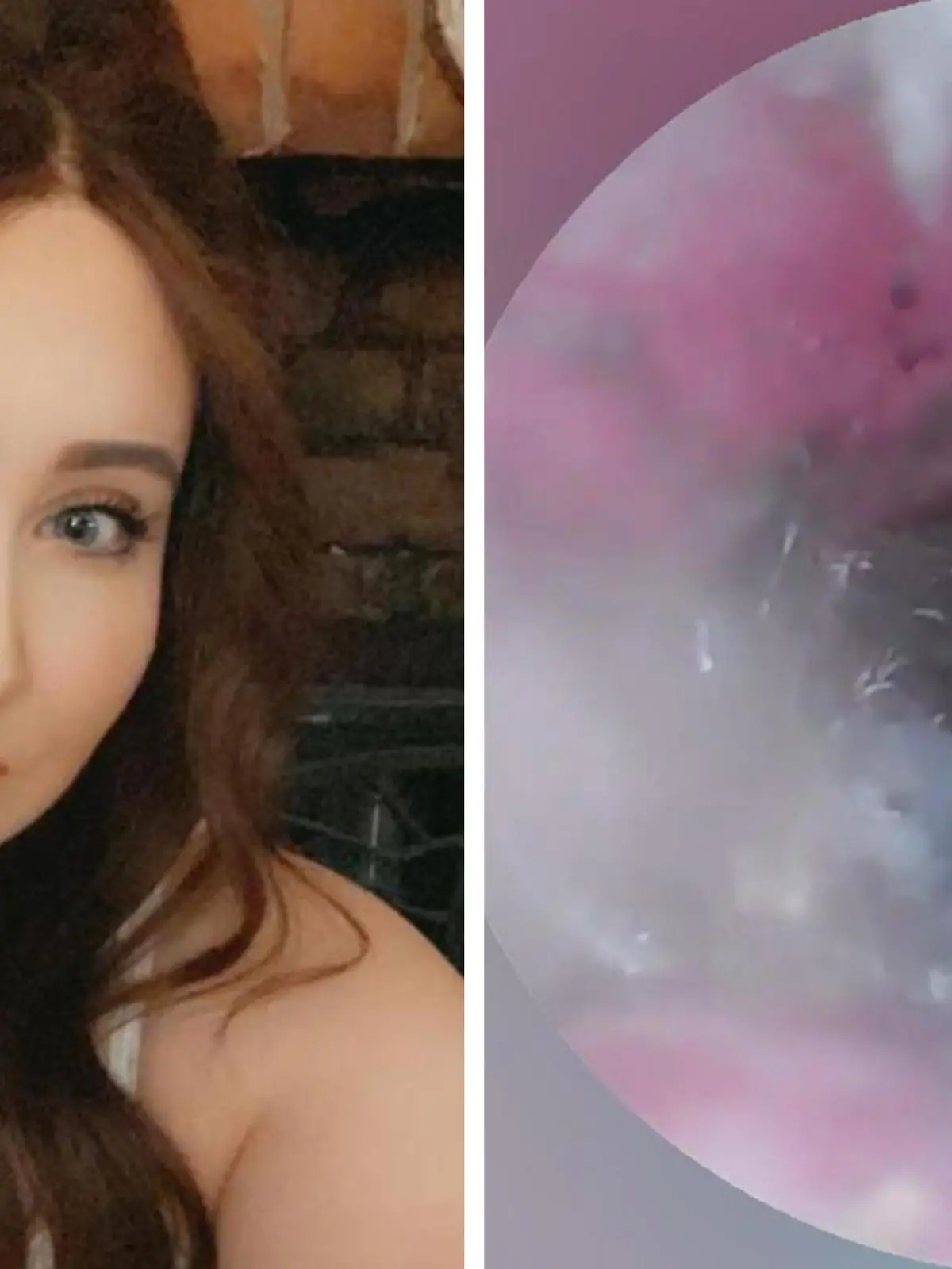 Lucy Wild (29) aus England hat plötzlich Ohrenschmerzen. Der Grund dafür ist wirklich eklig: Sie entdeckt eine Spinne in ihrem Ohr. Und es kommt noch viel schlimmer.