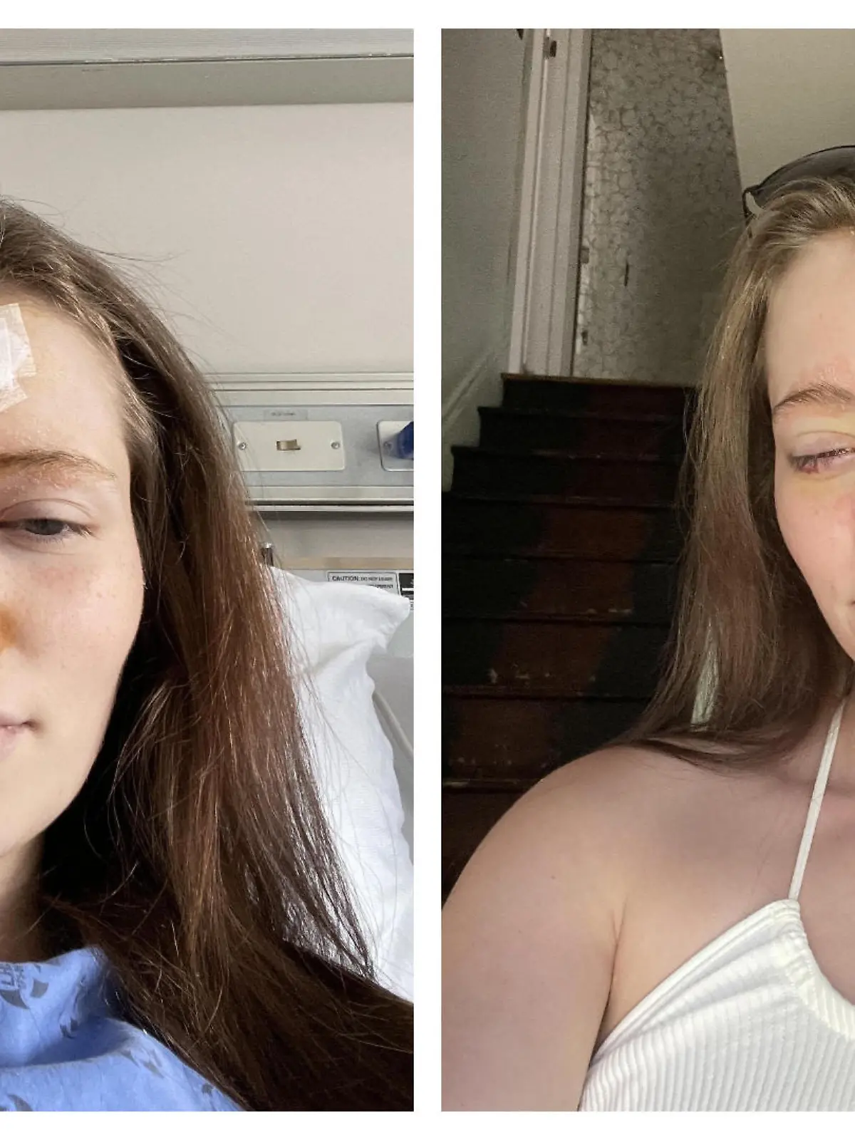 Taiva Finlayson nach ihrer Augenoperation.