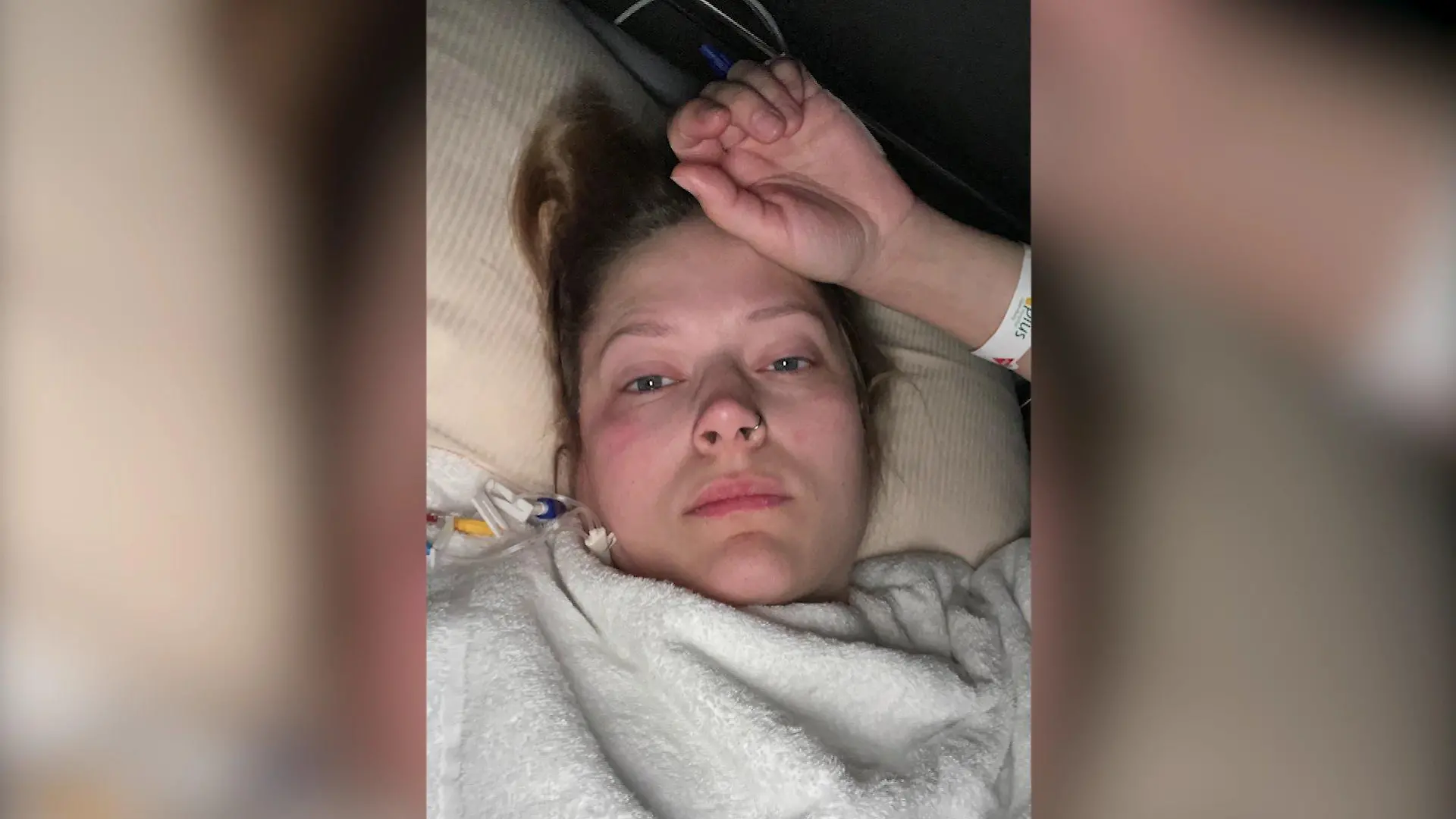 Nach dem Darmdurchbruch liegt Julia Hermeling wochenlang im Krankenhaus.