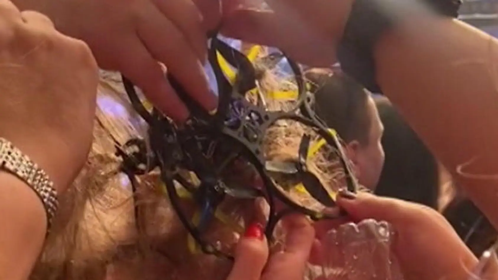 Drohne verfängt sich in Haaren