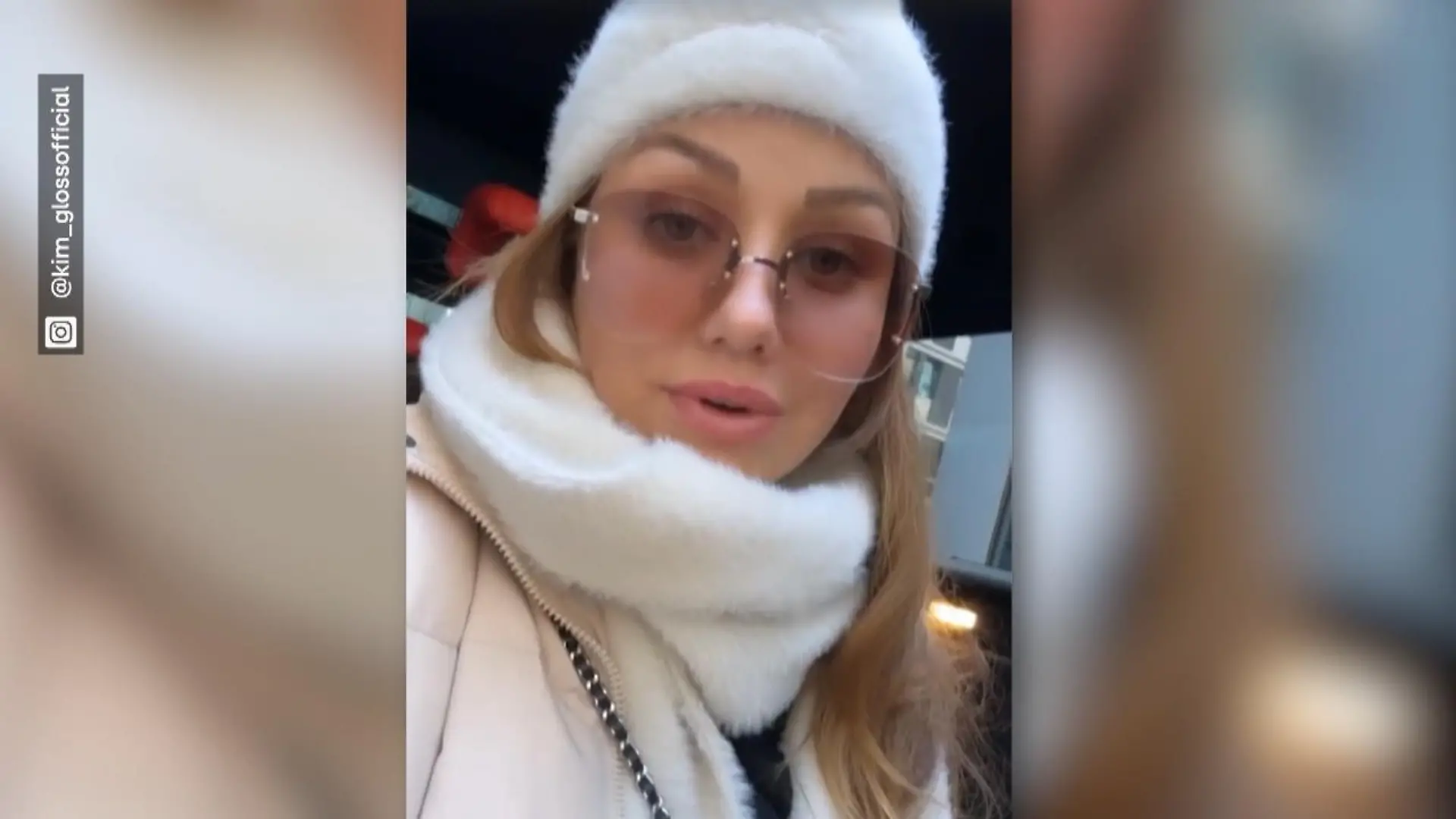 Kim Gloss: Milchstau und Fieber! Der BH war zu eng