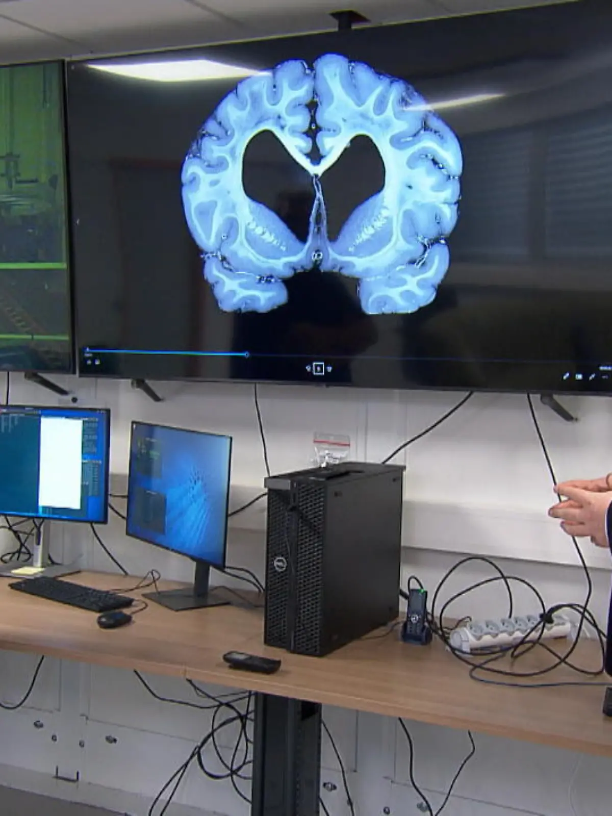Bild zu: " Neuer Scan DIE Medizin-Revolution?"