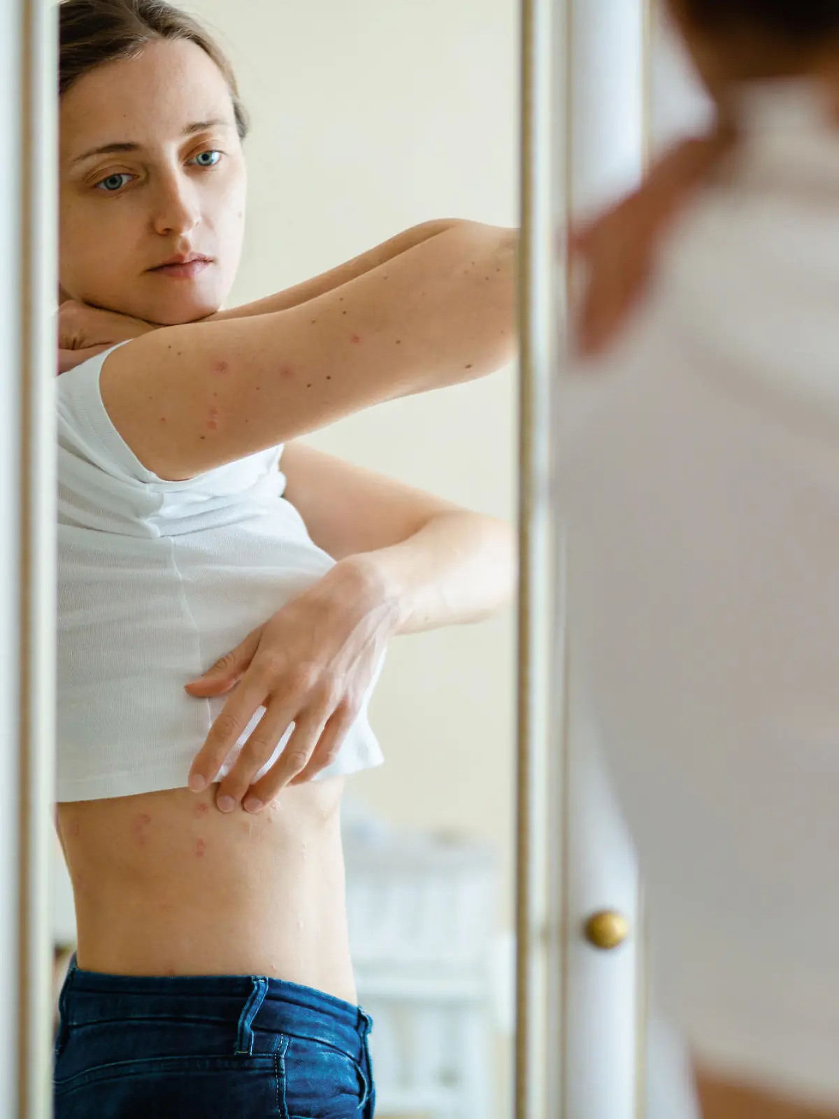 Woman looks in to a mirror an itching rash on dry flaky skin, as in the psoriasis, eczema and other diseases