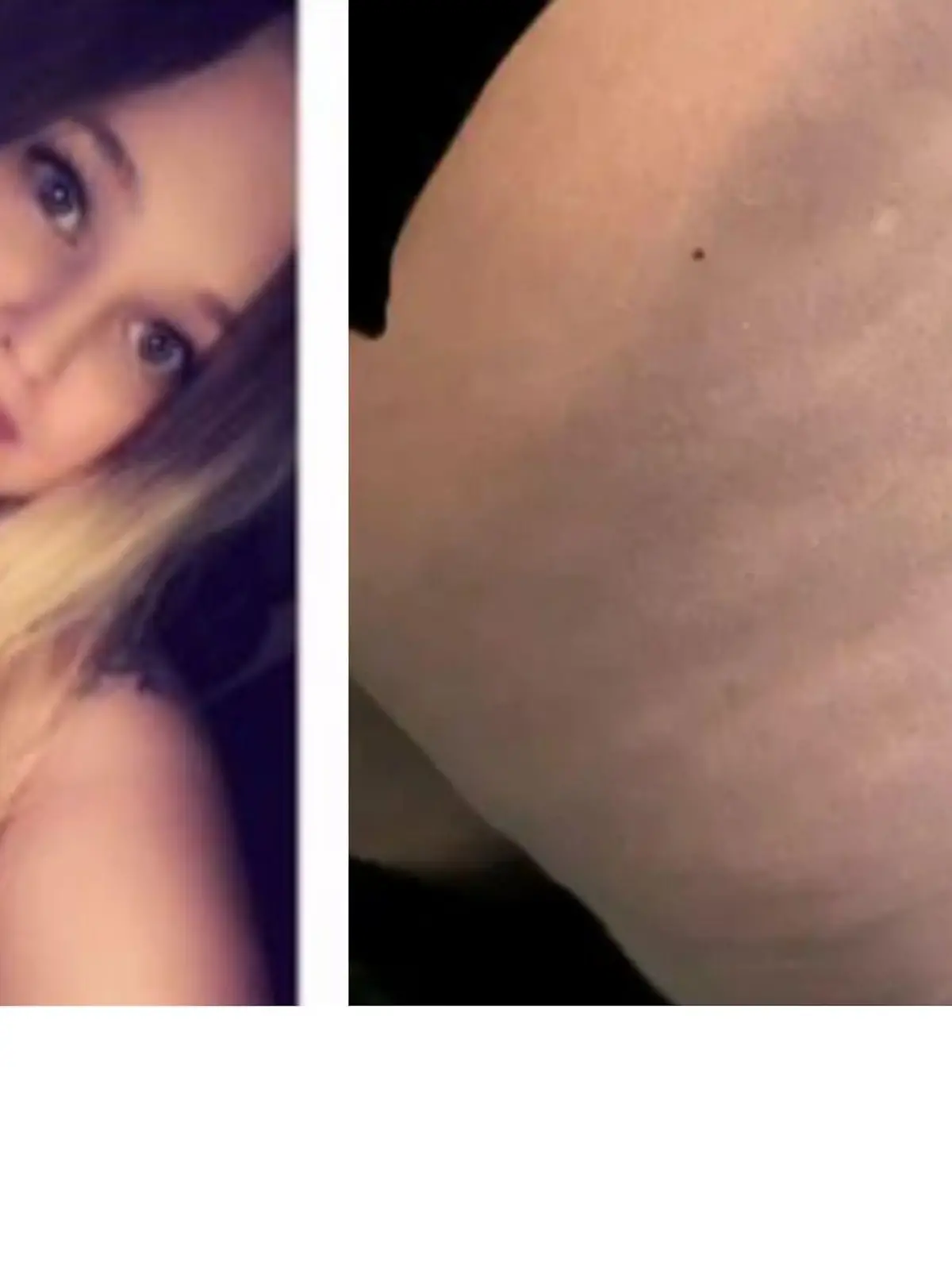 Malin Haraldsen ging wegen ihrer blauen Beine ins Krankenhaus -. und dort gab es eine überraschende Diagnose