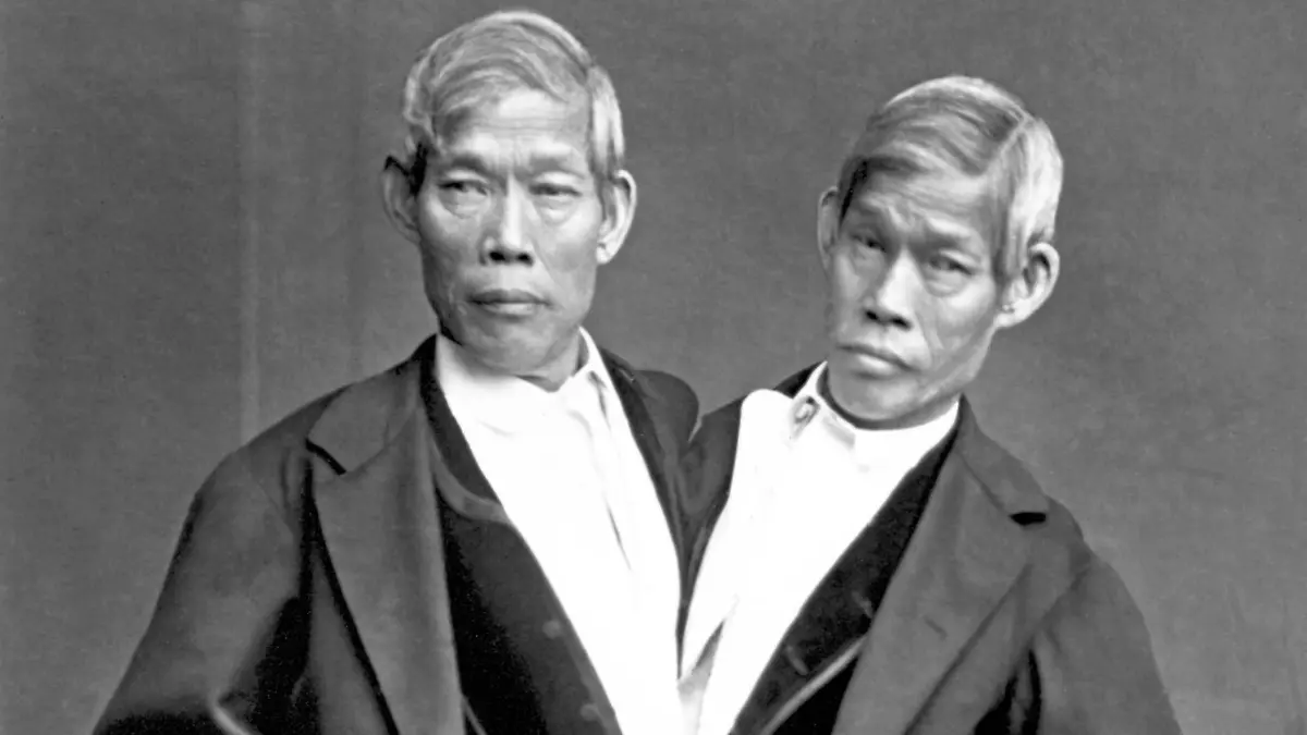 Chang and Eng Bunker (May 11, 1811  January 17, 1874) were Thai-American conjoined twin brothers whose condition and birthplace became the basis for the term 'Siamese twins'. The Bunker brothers were born on May 11, 1811, in the province of Samutsongkram, near Bangkok, in the Kingdom of Siam (today's Thailand). Their fisherman father was a Chinese Thai, while their mother was a Chinese Malaysian. Because of their Chinese heritage, they were known locally as the 'Chinese Twins'. The brothers were joined at the sternum by a small piece of cartilage, and though their livers were fused, they were independently complete. In 1829, Robert Hunter, a Scottish merchant who lived in Bangkok, saw the twins swimming and realized their potential. He paid their parents to permit him to exhibit their sons as a curiosity on a world tour. When their contract with Hunter was over, Chang and Eng went into business for themselves. In 1839, while visiting Wilkesboro, North Carolina, the brothers were attracted to the area and purchased a 110-acre (0.45 km2) farm in nearby Traphill.<br/><br/> Determined to live as normal a life they could, Chang and Eng settled on their small plantation and bought slaves to do the work they could not do themselves. Using their adopted name 'Bunker', they married local women on April 13, 1843. Chang wed Adelaide Yates, while Eng married her sister, Sarah Anne. Chang and Adelaide would become the parents of eleven children. Eng and Sarah had ten. The twins also became naturalized American citizens.<br/><br/> On January 17, 1874, Chang died while the brothers were asleep. Eng awoke to find his brother dead and cried, 'Then I am going'. A doctor was summoned to perform an emergency separation, but he was too late. Eng died approximately three hours later.