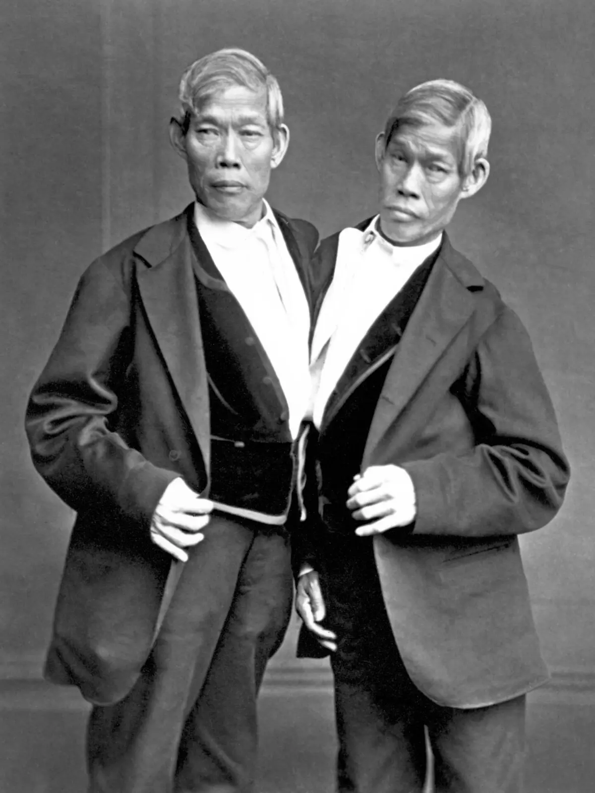 Chang and Eng Bunker (May 11, 1811  January 17, 1874) were Thai-American conjoined twin brothers whose condition and birthplace became the basis for the term 'Siamese twins'. The Bunker brothers were born on May 11, 1811, in the province of Samutsongkram, near Bangkok, in the Kingdom of Siam (today's Thailand). Their fisherman father was a Chinese Thai, while their mother was a Chinese Malaysian. Because of their Chinese heritage, they were known locally as the 'Chinese Twins'. The brothers were joined at the sternum by a small piece of cartilage, and though their livers were fused, they were independently complete. In 1829, Robert Hunter, a Scottish merchant who lived in Bangkok, saw the twins swimming and realized their potential. He paid their parents to permit him to exhibit their sons as a curiosity on a world tour. When their contract with Hunter was over, Chang and Eng went into business for themselves. In 1839, while visiting Wilkesboro, North Carolina, the brothers were attracted to the area and purchased a 110-acre (0.45 km2) farm in nearby Traphill.<br/><br/> Determined to live as normal a life they could, Chang and Eng settled on their small plantation and bought slaves to do the work they could not do themselves. Using their adopted name 'Bunker', they married local women on April 13, 1843. Chang wed Adelaide Yates, while Eng married her sister, Sarah Anne. Chang and Adelaide would become the parents of eleven children. Eng and Sarah had ten. The twins also became naturalized American citizens.<br/><br/> On January 17, 1874, Chang died while the brothers were asleep. Eng awoke to find his brother dead and cried, 'Then I am going'. A doctor was summoned to perform an emergency separation, but he was too late. Eng died approximately three hours later.