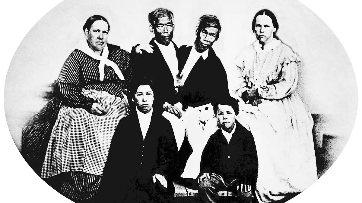 Chang and Eng Bunker (May 11, 1811  January 17, 1874) were Thai-American conjoined twin brothers whose condition and birthplace became the basis for the term 'Siamese twins'. The Bunker brothers were born on May 11, 1811, in the province of Samutsongkram, near Bangkok, in the Kingdom of Siam (today's Thailand). Their fisherman father was a Chinese Thai, while their mother was a Chinese Malaysian. Because of their Chinese heritage, they were known locally as the 'Chinese Twins'. The brothers were joined at the sternum by a small piece of cartilage, and though their livers were fused, they were independently complete. In 1829, Robert Hunter, a Scottish merchant who lived in Bangkok, saw the twins swimming and realized their potential. He paid their parents to permit him to exhibit their sons as a curiosity on a world tour. When their contract with Hunter was over, Chang and Eng went into business for themselves. In 1839, while visiting Wilkesboro, North Carolina, the brothers were attracted to the area and purchased a 110-acre (0.45 km2) farm in nearby Traphill.<br/><br/> Determined to live as normal a life they could, Chang and Eng settled on their small plantation and bought slaves to do the work they could not do themselves. Using their adopted name 'Bunker', they married local women on April 13, 1843. Chang wed Adelaide Yates, while Eng married her sister, Sarah Anne. Chang and Adelaide would become the parents of eleven children. Eng and Sarah had ten. The twins also became naturalized American citizens.<br/><br/> On January 17, 1874, Chang died while the brothers were asleep. Eng awoke to find his brother dead and cried, 'Then I am going'. A doctor was summoned to perform an emergency separation, but he was too late. Eng died approximately three hours later.