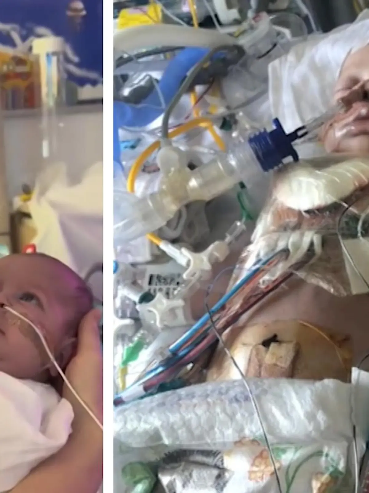 Die Ärzte können diesen Moment kaum glauben: Zofia kann endlich ihre Tochter im Arm halten – ein dramatischer Überlebenskampf liegt hinter der Kleinen. Dorothea kam mit einer unterentwickelten Herzhälfte zur Welt. Mit einer Überlebenschance von 5% wird den Eltern geraten die Schwangerschaft abzubrechen: Für beide keine Option. Wir zeigen die Geschichte im Video.