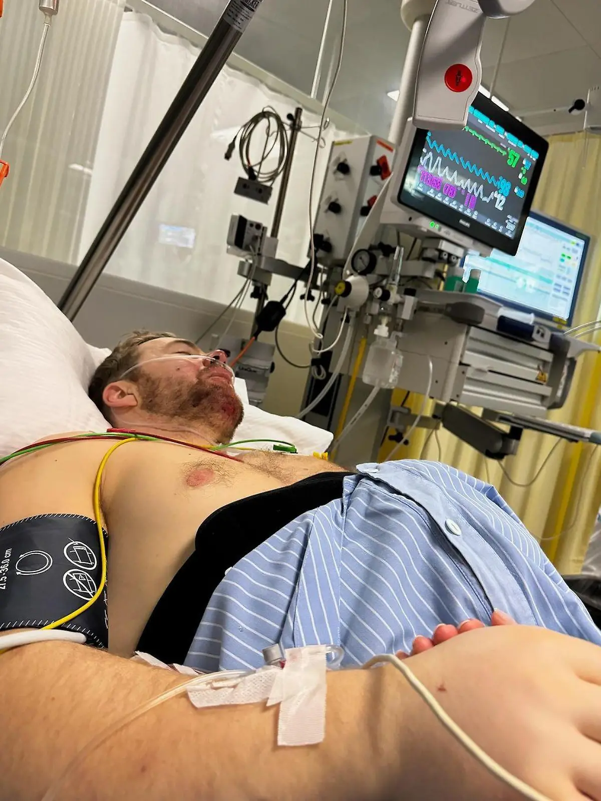 Ski-Star Aleksander Aamodt Kilde gibt ein Update nach dem Horror-Sturz.