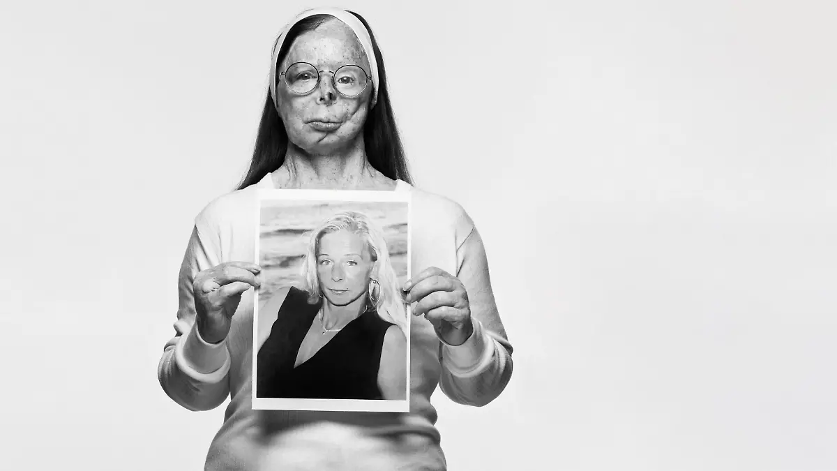 Acid attack survivor and campaigner Patricia Lefranc poses for a picture shot by British photographer Rankin for the 'Tear Couture' lookbook campaign in London, Britain, in this undated handout photo obtained by Reuters on January 17, 2024. McCann Health London/Rankin/Handout via REUTERS    THIS IMAGE HAS BEEN SUPPLIED BY A THIRD PARTY. MANDATORY CREDIT. NO RESALES. NO ARCHIVES. NO NEW USES AFTER FEBRUARY 23, 2024.