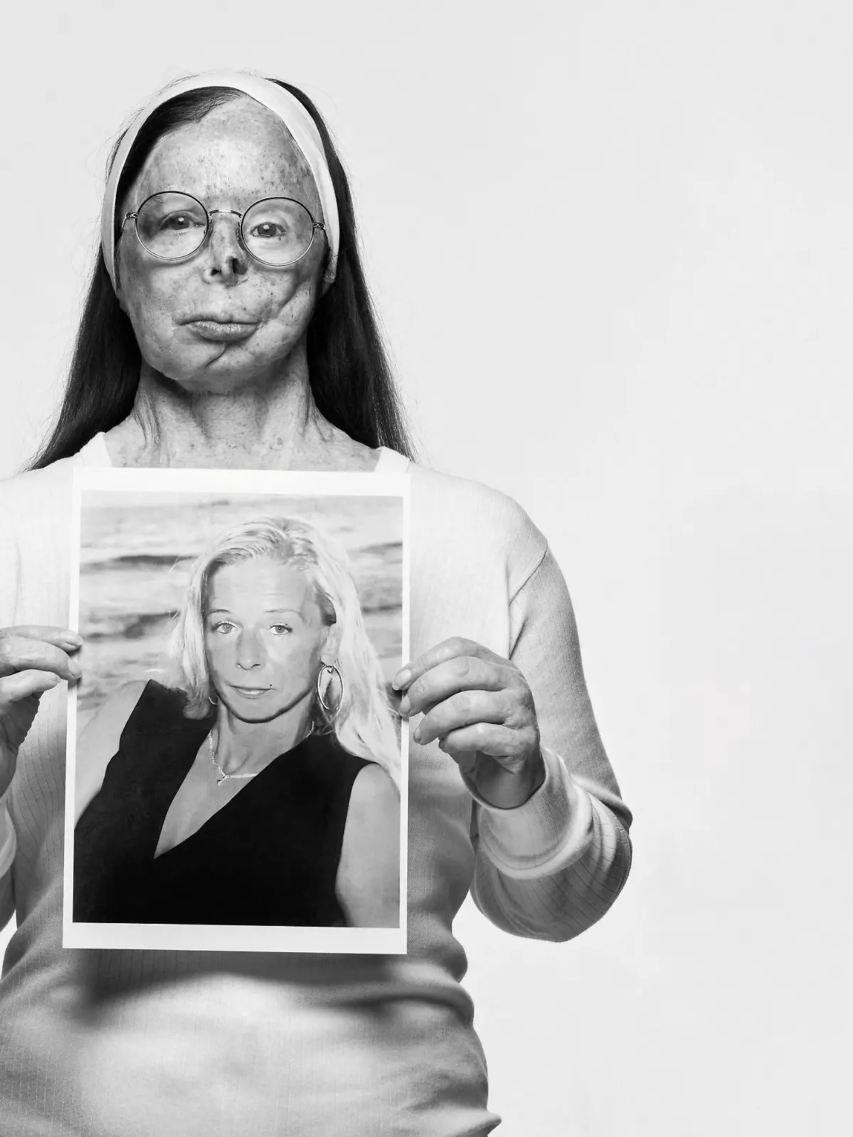 Acid attack survivor and campaigner Patricia Lefranc poses for a picture shot by British photographer Rankin for the 'Tear Couture' lookbook campaign in London, Britain, in this undated handout photo obtained by Reuters on January 17, 2024. McCann Health London/Rankin/Handout via REUTERS    THIS IMAGE HAS BEEN SUPPLIED BY A THIRD PARTY. MANDATORY CREDIT. NO RESALES. NO ARCHIVES. NO NEW USES AFTER FEBRUARY 23, 2024.