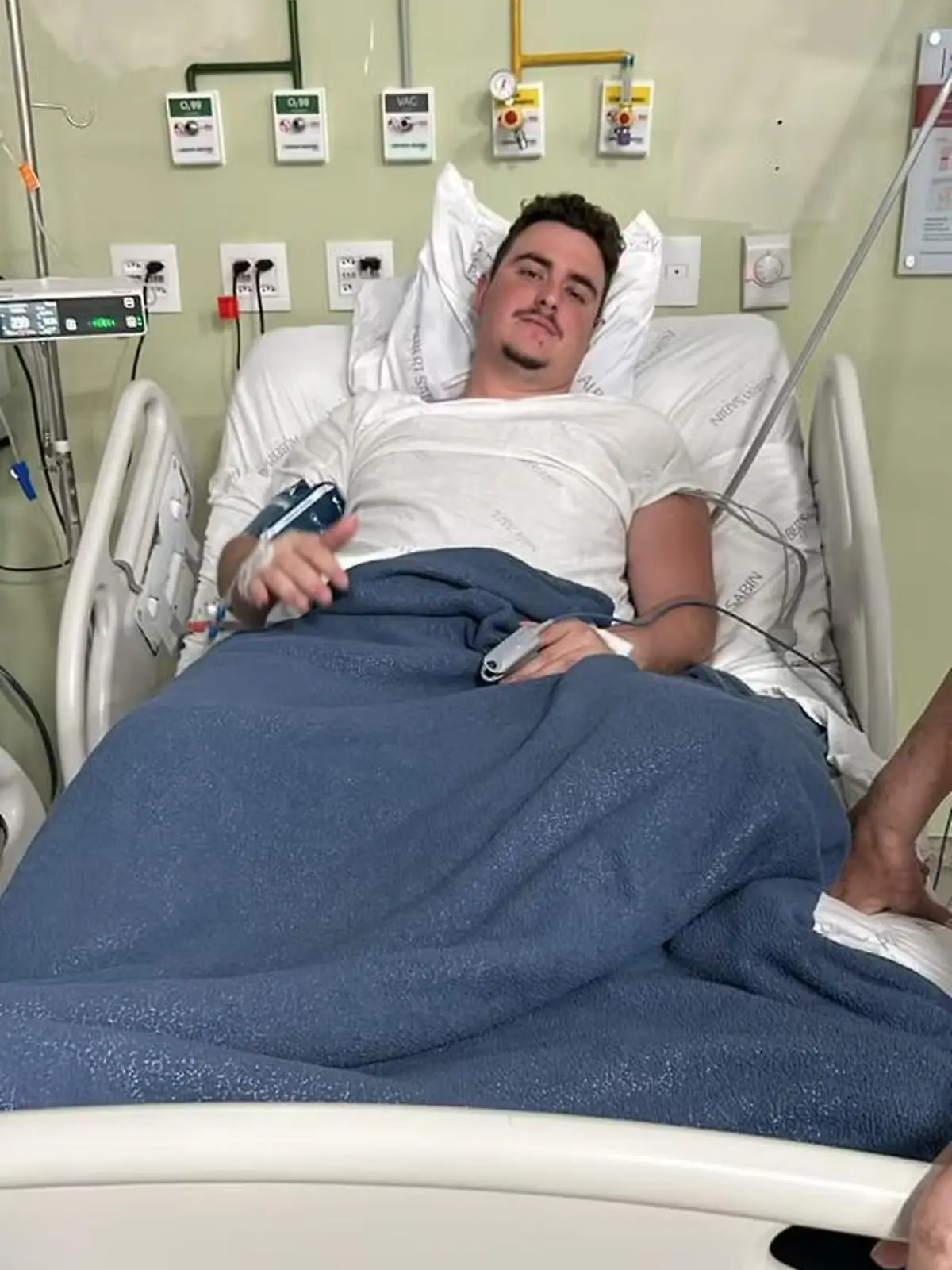 Story from Jam Press (Lad Bullet Head) 

Pictured: Mateus Facio in hospital.

Man who thought he was hit by a stone found out four days later that he had a bullet in his head

A young man who thought someone had chucked a stone at him found out four days later he had a bullet lodged in his head.

Mateus Facio was having fun with his pals on the beach when he felt something hit him.

The 21-year-old said: “I thought it was a bad joke.

“Like someone had picked up and thrown a stone. Because I didn’t hear anything.

“If I’d heard a noise, I might have suspected something.”

“But I didn’t hear anything, everything seemed perfectly normal.” he told local media.

Mateus continued enjoying the beach in Cabo Frio, east of Rio de Janeiro, Brazil.

But after returning home to Juiz de Fora, his arms and fingers stopped moving normally and he ended up going to hospital for tests.

He was stunned when medics told him he had a 9mm bullet lodged in his head.

Mateus had an operation to remove the projectile.

Neurosurgeon Flávio Falcometa told local media: “The bullet was compressing the brain in an area close to the region responsible for the movement of the right arm, causing irritation.

“This led to the brain to respond with movements that manifested as convulsive episodes.

“It was in an area very close to what we call the motor area of the brain, which is responsible for movement.

“The bullet could have caused much more serious damage, potentially leaving his arm or half of his body paralysed.”

The removed bullet was sent to the police in Cabo Frio, who are investigating the case.

They say there were no reports of shootings in the area on that day.

Mateus spent two days in the ICU.

His mum, Luciana, recalled: “The doctor explained the situation, that Mateus would have to undergo surgery to remove the bullet, and he would run some risks, albeit minor.

“There were concerns about bleeding, leakage of cerebral fluid, meningitis, and even d