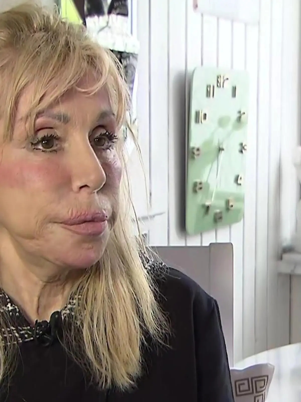Maria Weller hat gewiss andere Sorgen, als die Nachwirkungen dieser einen Entscheidung, die sie vor mittlerweile 23 Jahren getroffen hat - und die sie heute so sehr bedauert! Ihr Mann, die Boxlegende René Weller, ist stark an Demenz erkrankt. Es heißt sogar, der 69-Jährige liege im Sterben. Zeitgleich bekommt seine Frau überall Ausschlag am Körper - denn die Silikonimplantate, die sie sich mit 47 Jahren hat einsetzen lassen, werden von ihrem Körper abgestoßen. Was folgt, ist eine Not-OP - ausgerechnet in dieser nervenzerreibenden Zeit.