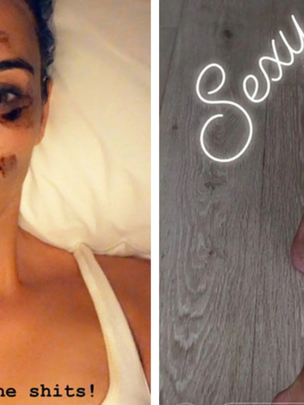 Kim Kardashian zeigt auf Instagram ihre Schuppenflechte.