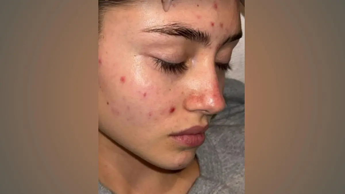Leni Klum zeigt auf Instagram die ungeschminkte Wahrheit.
