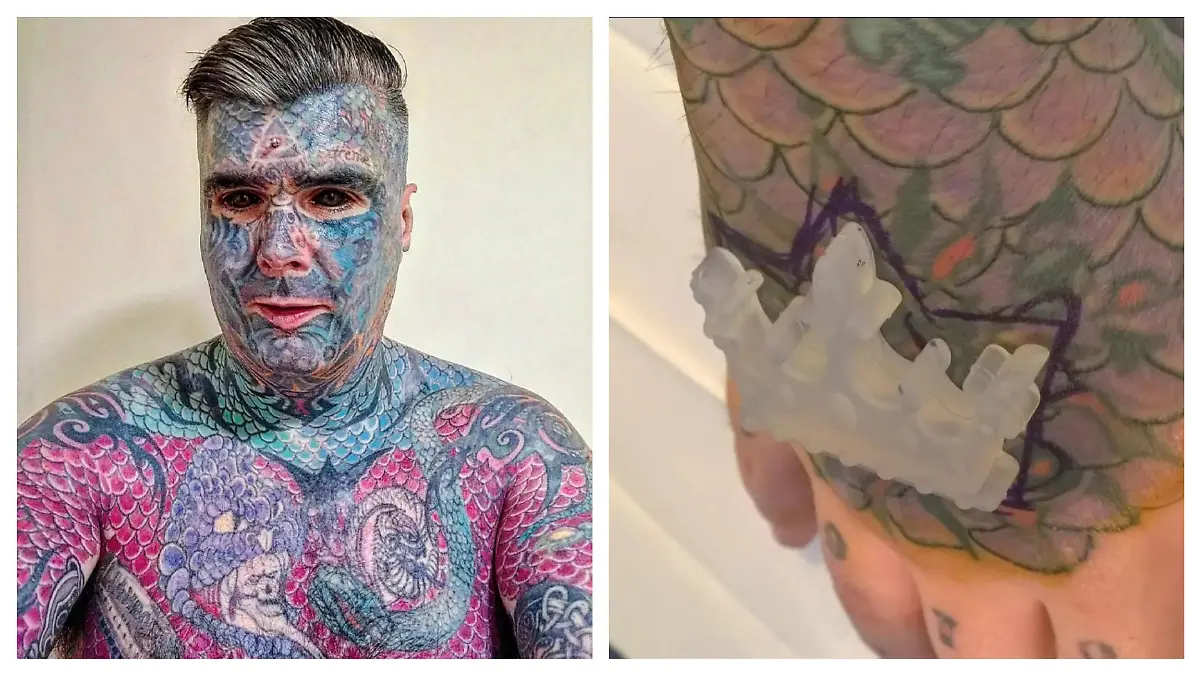 Body Art und sein Kronenimplantat