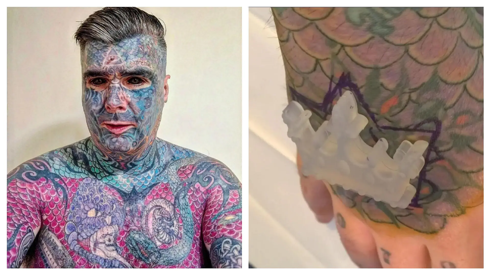 Body Art und sein Kronenimplantat