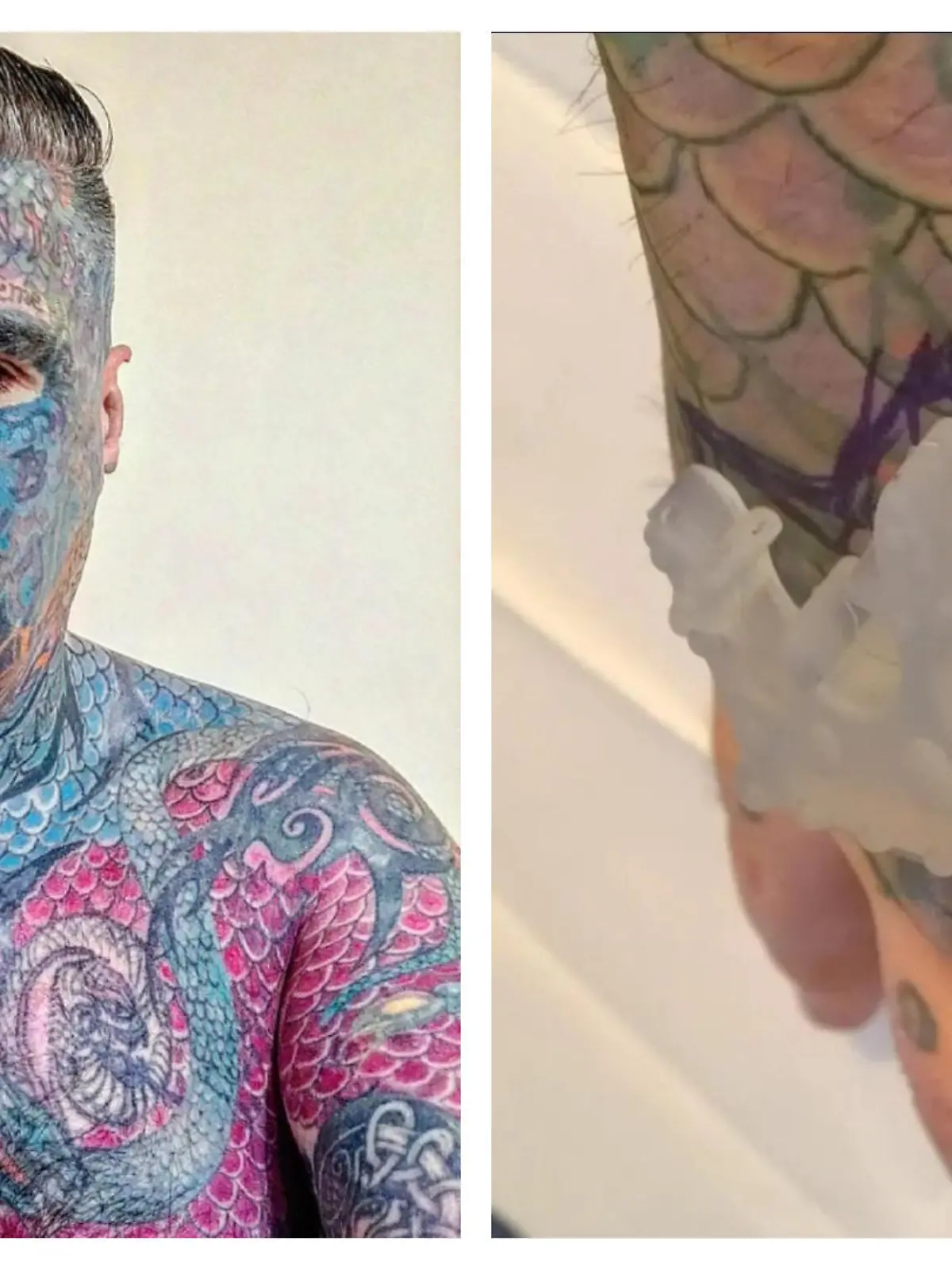 Body Art und sein Kronenimplantat