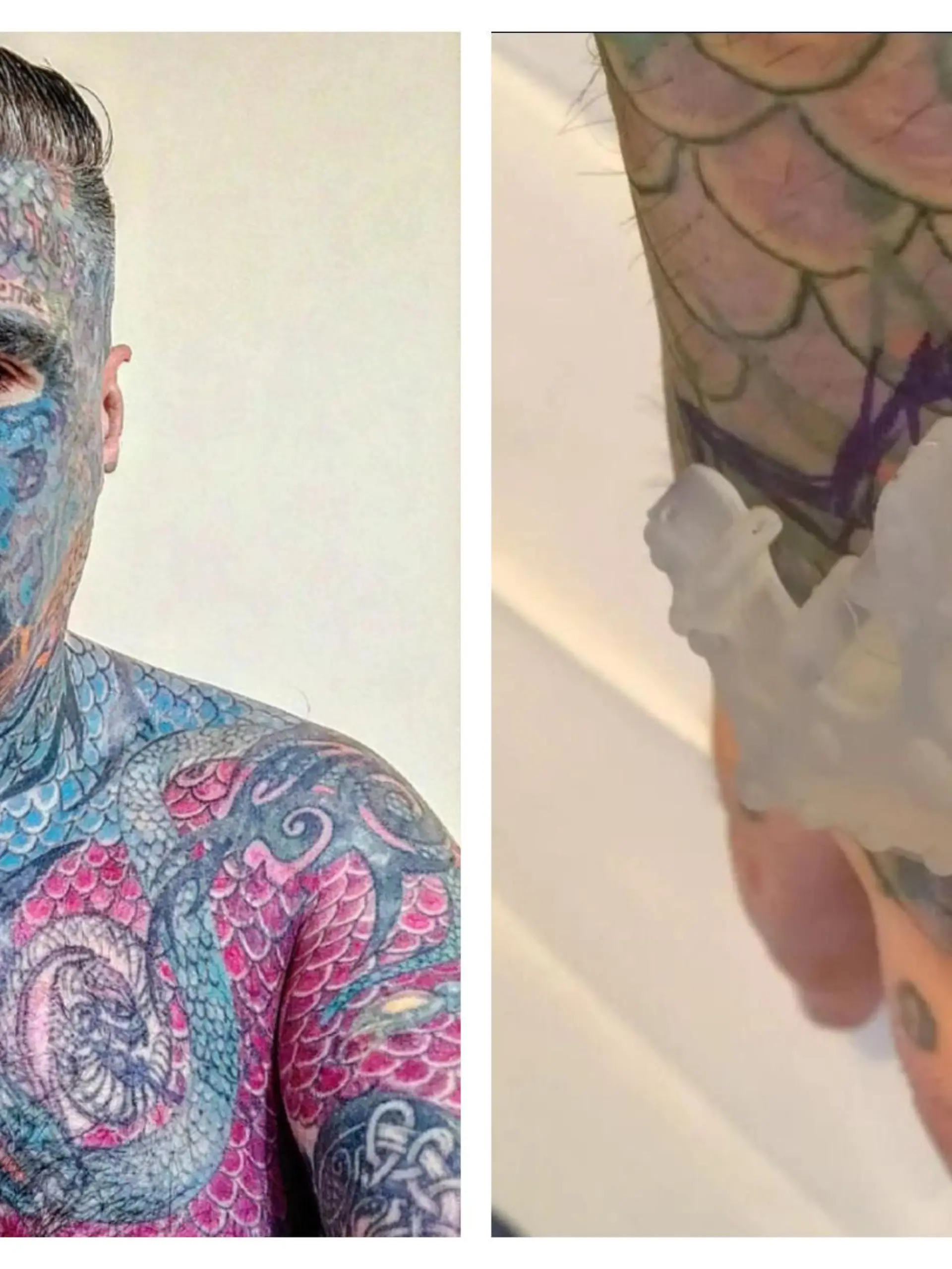 Body Art und sein Kronenimplantat