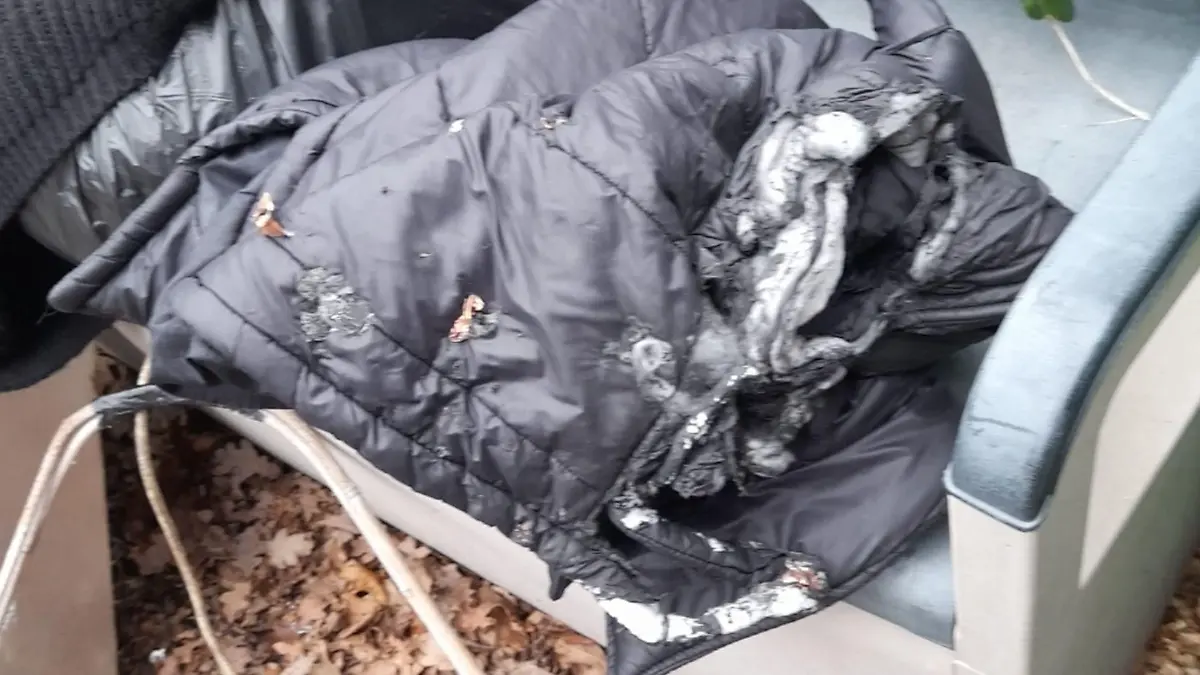 Vape-Zigarettenakku explodiert in Daunenjacke! Leeanne (43): Ich bin froh,  dass ich noch lebe