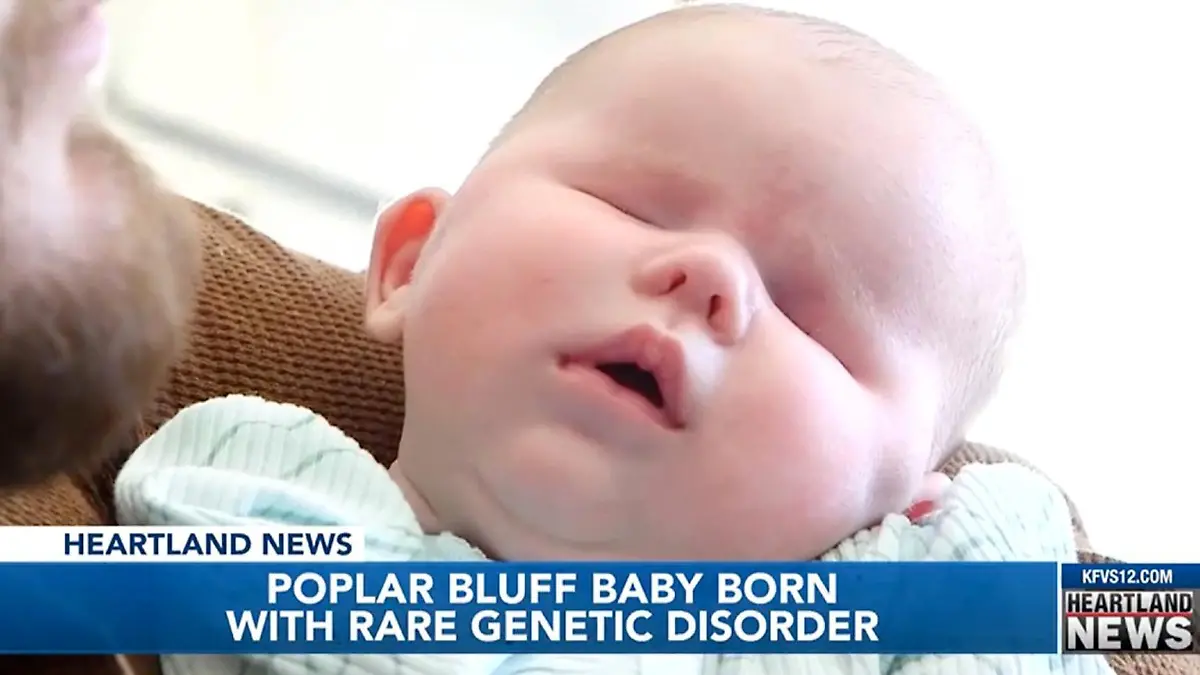 Die kleine Wrenley wurde aufgrund eines sehr seltenen Gendeffekts ohne Augen geboren