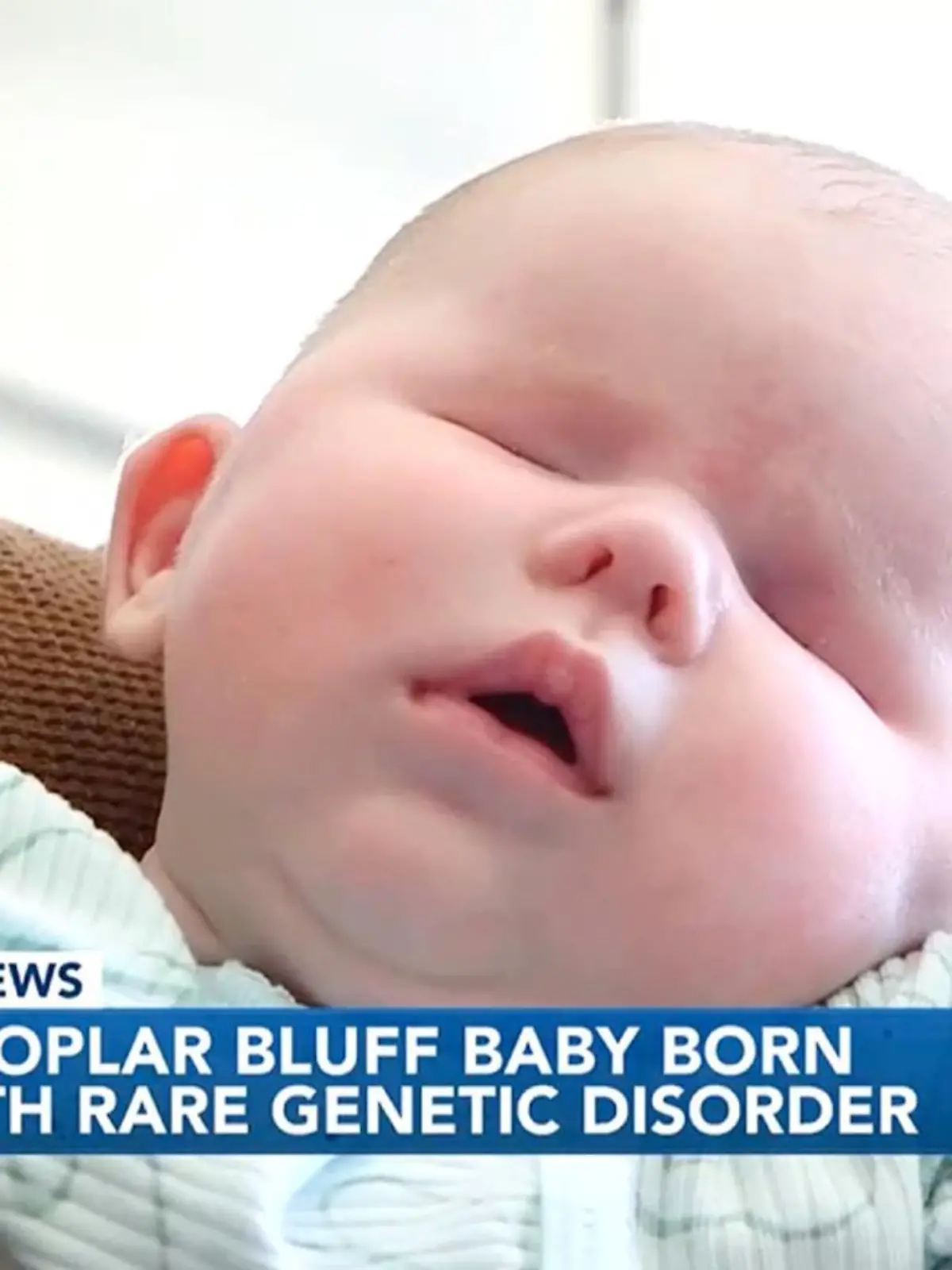 Die kleine Wrenley wurde aufgrund eines sehr seltenen Gendeffekts ohne Augen geboren