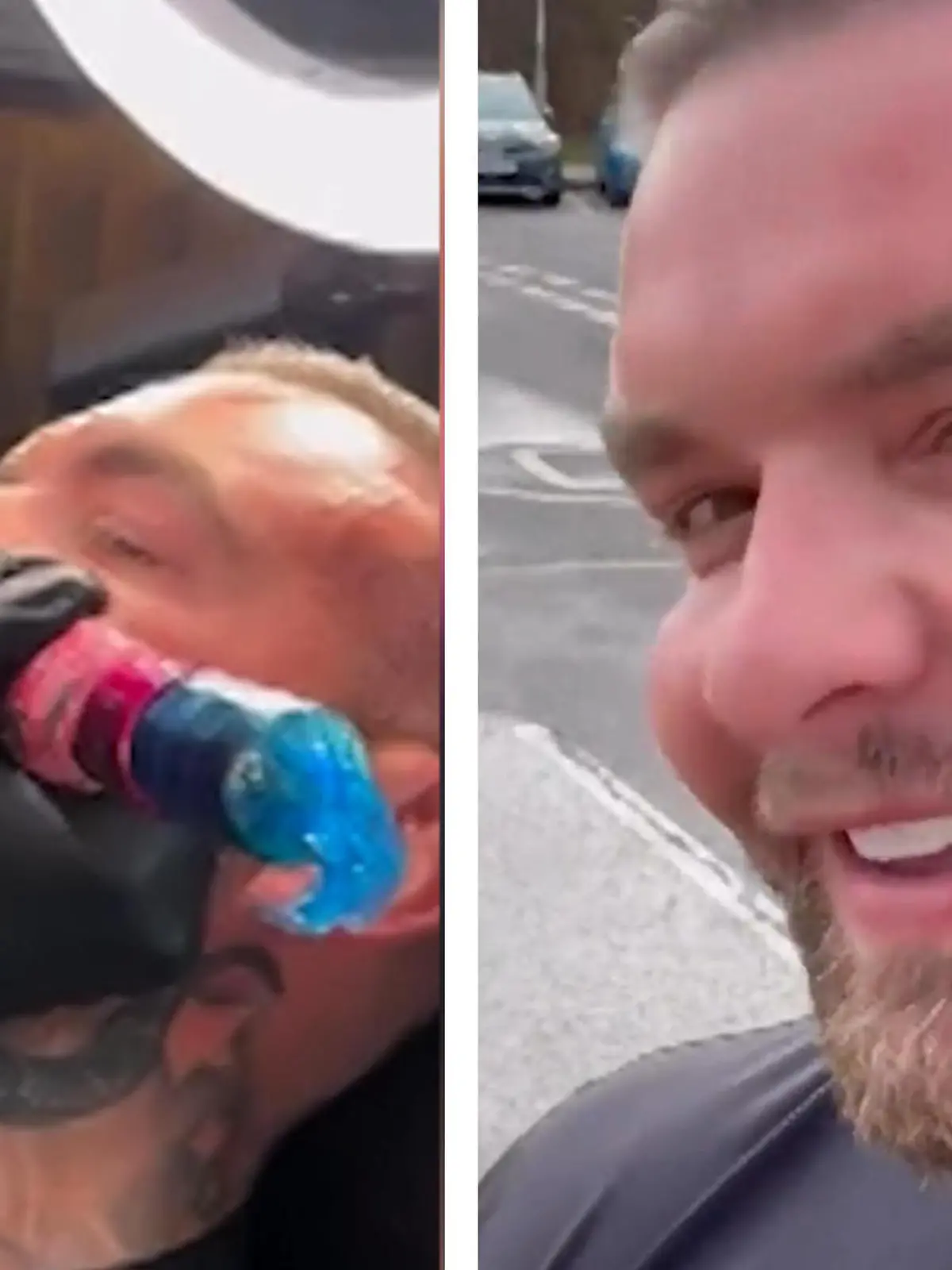 Genau das wollte Erotikdarsteller Andy Lee (35) aus Dublin unter anderem wissen. Er hat vorgetäuscht sich ein Tattoo stechen zu lassen und zwar mitten ins Gesicht. Aber nicht irgendein Tattoo, sondern den Schriftzug ‘OnlyFans’. Andy Lee arbeitet auf der Plattform, sagt das habe sein Leben verändert. Was er aber genau mit dem Experiment bewirken wollte und welche Erfahrung er gemacht hat, seht ihr im Video.