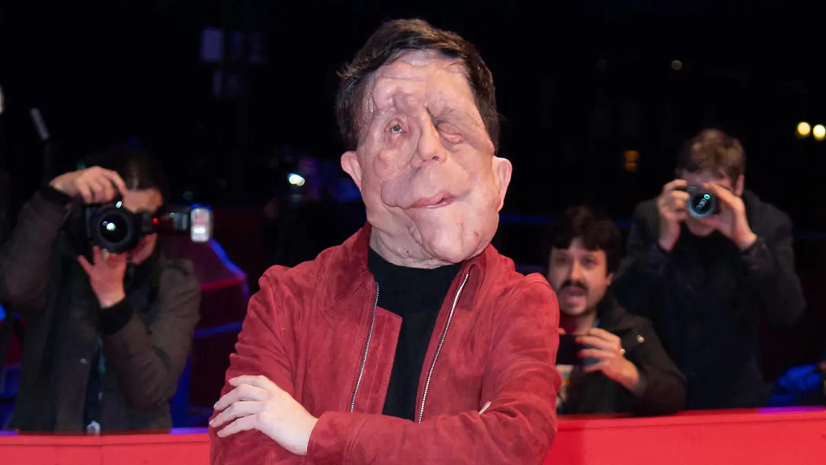 Berlinale A different Man Premiere Adam Pearson attending the A different Man Premiere during the 74th Berlinale International Film Festival Berlin at Grand Hyatt Hotel in Berlin, Germany, on February 16, 2024. Photo by Aurore Marechal/ABACAPRESS.COM Berlin Germany PUBLICATIONxNOTxINxFRAxESPxUKxUSAxBELxPOL Copyright: xMarechalxAurore/ABACAx
