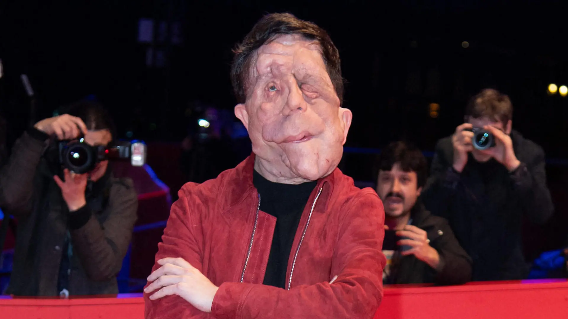 Berlinale A different Man Premiere Adam Pearson attending the A different Man Premiere during the 74th Berlinale International Film Festival Berlin at Grand Hyatt Hotel in Berlin, Germany, on February 16, 2024. Photo by Aurore Marechal/ABACAPRESS.COM Berlin Germany PUBLICATIONxNOTxINxFRAxESPxUKxUSAxBELxPOL Copyright: xMarechalxAurore/ABACAx