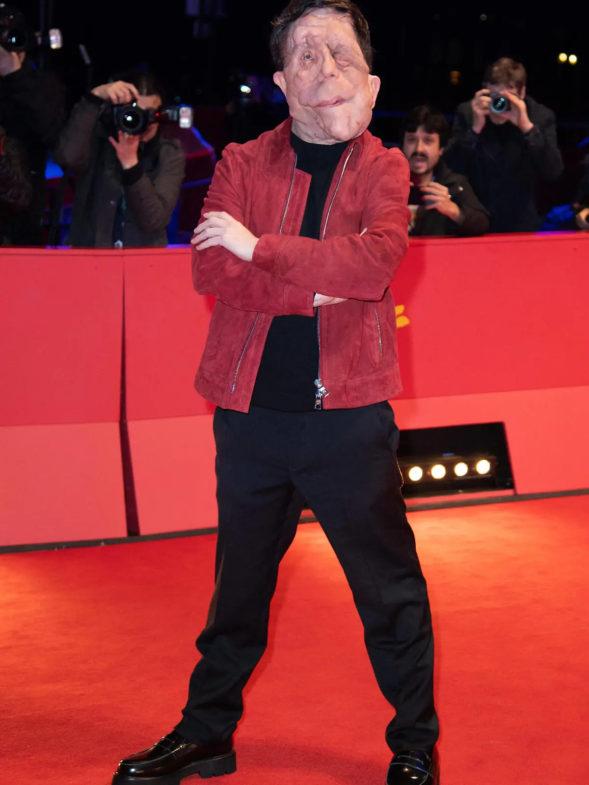 Berlinale A different Man Premiere Adam Pearson attending the A different Man Premiere during the 74th Berlinale International Film Festival Berlin at Grand Hyatt Hotel in Berlin, Germany, on February 16, 2024. Photo by Aurore Marechal/ABACAPRESS.COM Berlin Germany PUBLICATIONxNOTxINxFRAxESPxUKxUSAxBELxPOL Copyright: xMarechalxAurore/ABACAx