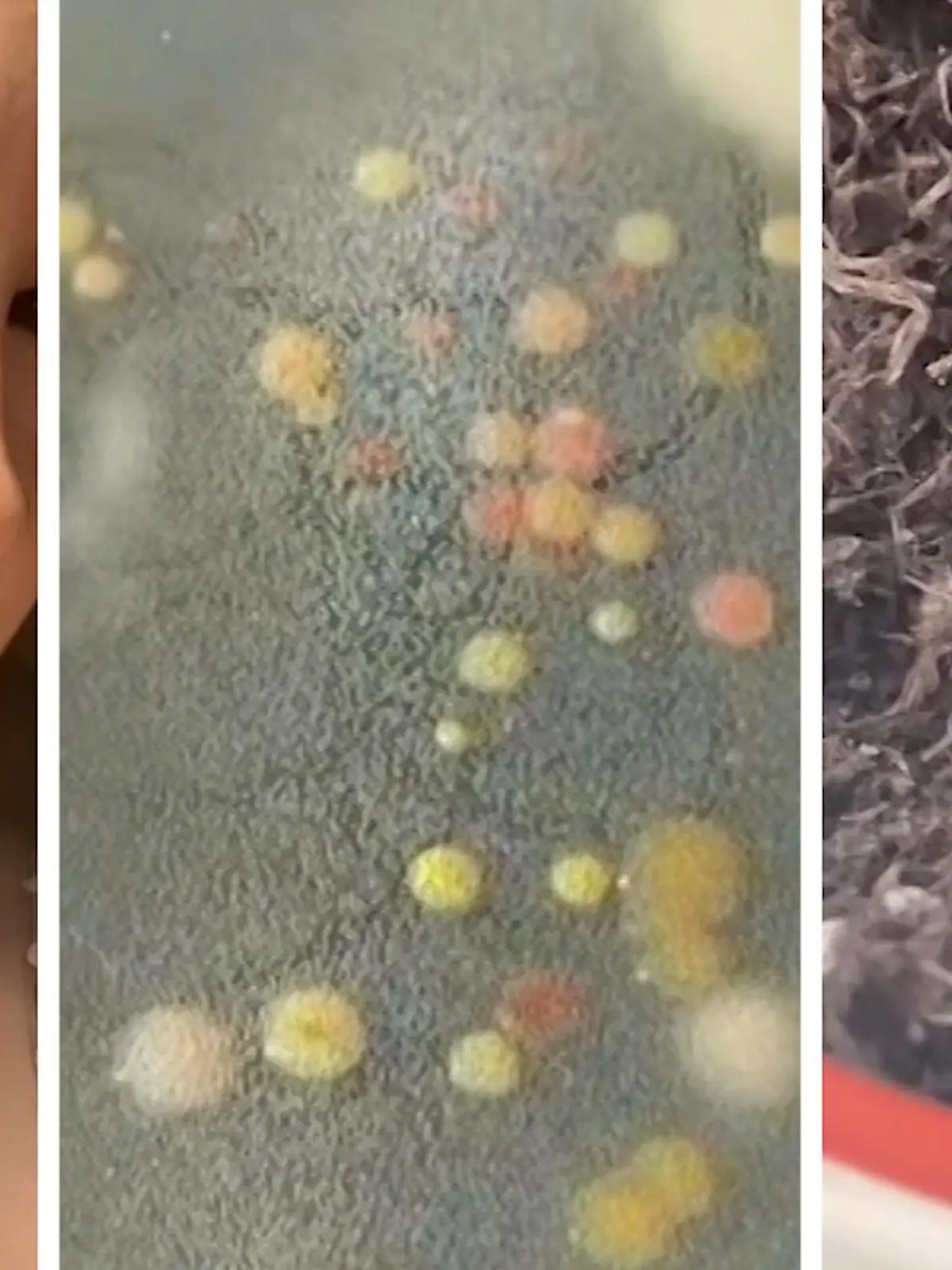 Fein säuberlich nimmt Chloe Fitzpatrick Proben von ihrer Haut. Ein Abstrich aus der Achselhöhle, einer von der Fußsohle und einer unterhalb der Brust – aus den daraus gewonnen Bakterien will sie Schmuck herstellen! Wie das geht, verrät sie im Video. 