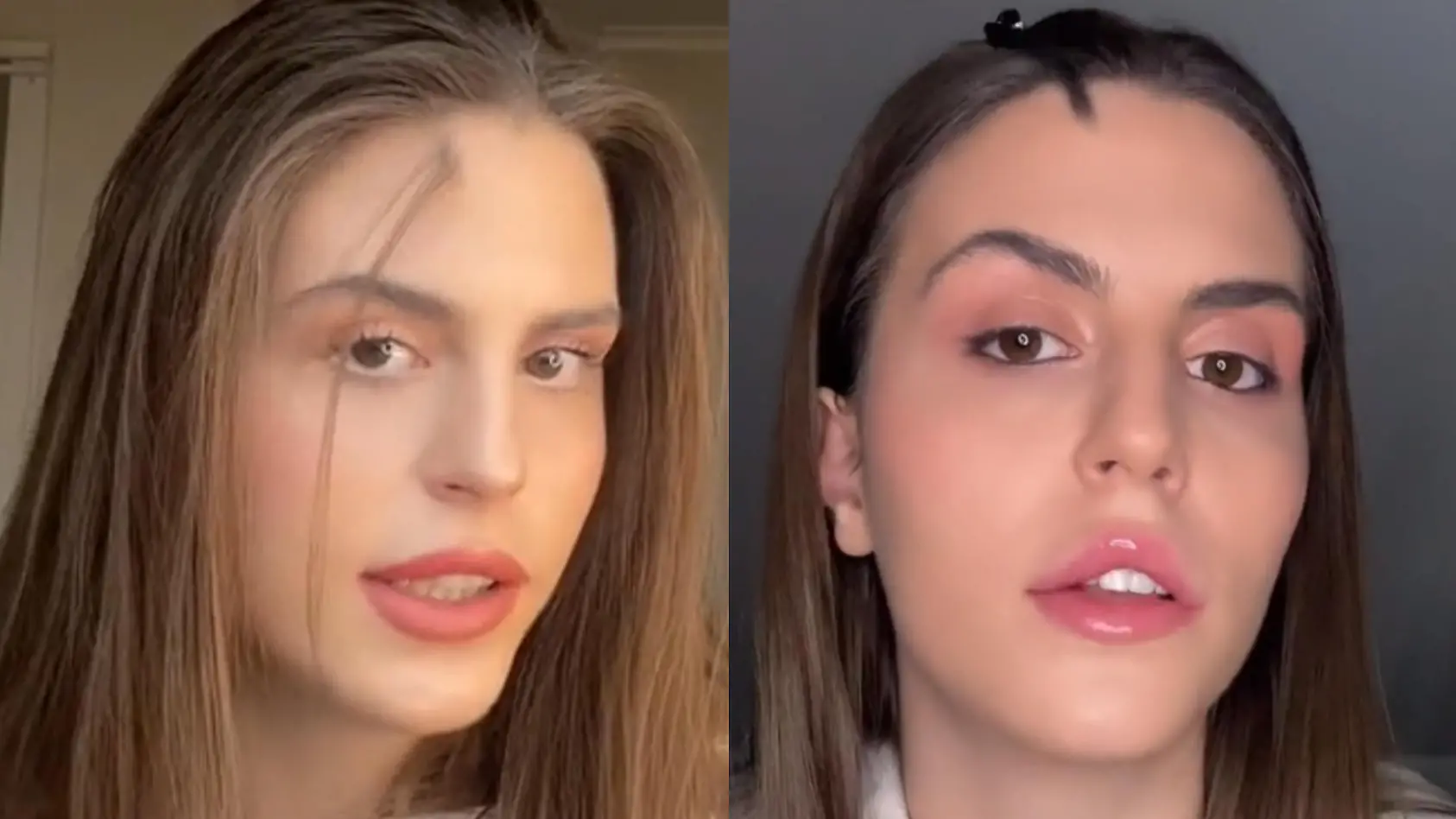 Model Rada liebt ihren Geburtsfehler