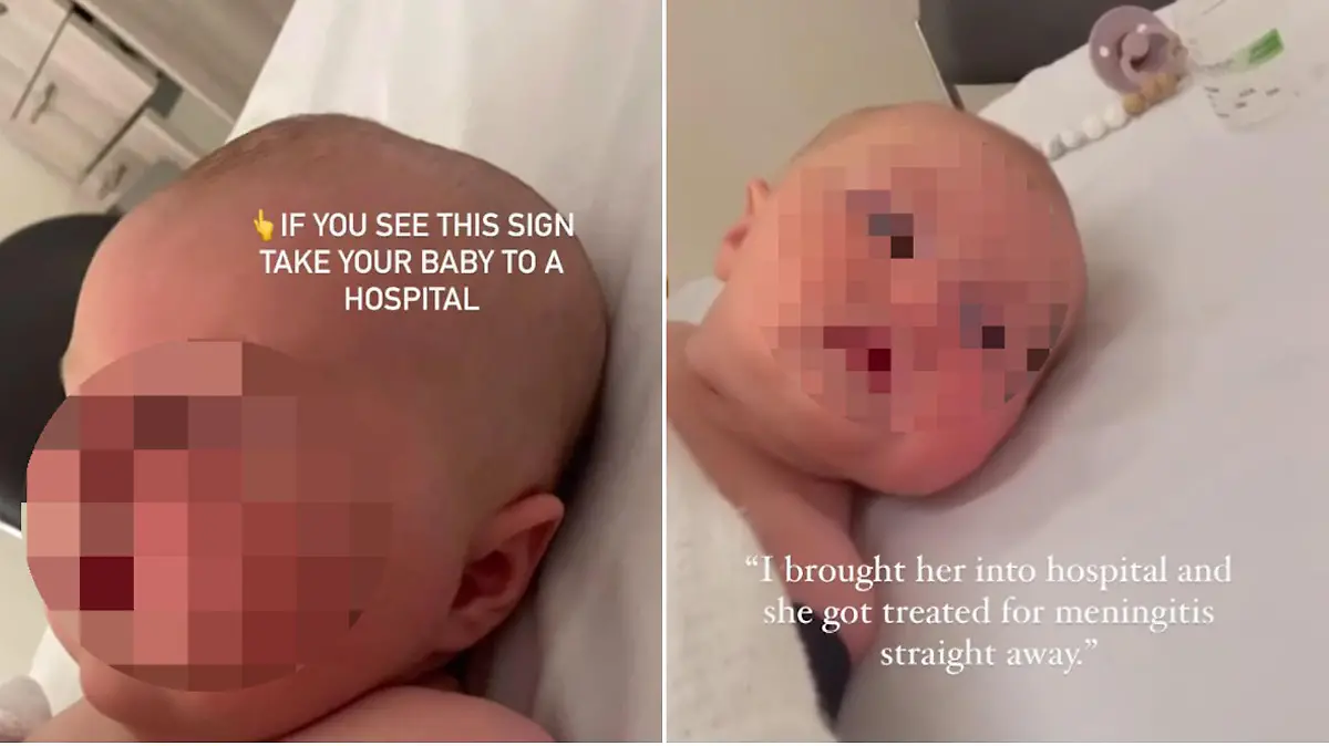 Baby mit Beule am Kopf