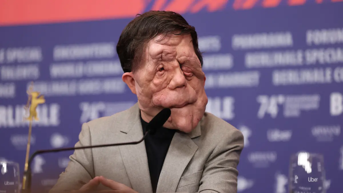 16.02.2024, Berlin: Adam Pearson, Schauspieler, während der Pressekonferenz zum Film "A Different Man" (Sektion Wettbewerb) bei der Berlinale. Die 74. Internationalen Filmfestspiele Berlin finden vom 15. - 25.02.2024 statt. (zu dpa: «Favoriten und Hollywood-Besuch: Darüber spricht man auf der Berlinale») Foto: Gerald Matzka/dpa +++ dpa-Bildfunk +++