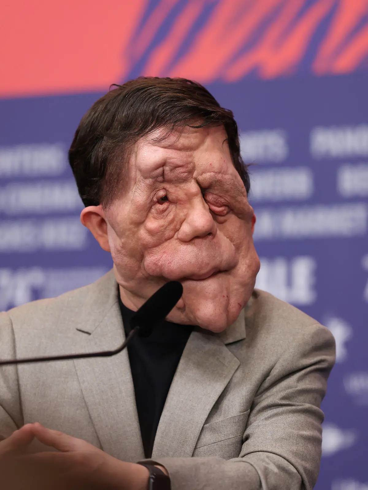 16.02.2024, Berlin: Adam Pearson, Schauspieler, während der Pressekonferenz zum Film "A Different Man" (Sektion Wettbewerb) bei der Berlinale. Die 74. Internationalen Filmfestspiele Berlin finden vom 15. - 25.02.2024 statt. (zu dpa: «Favoriten und Hollywood-Besuch: Darüber spricht man auf der Berlinale») Foto: Gerald Matzka/dpa +++ dpa-Bildfunk +++