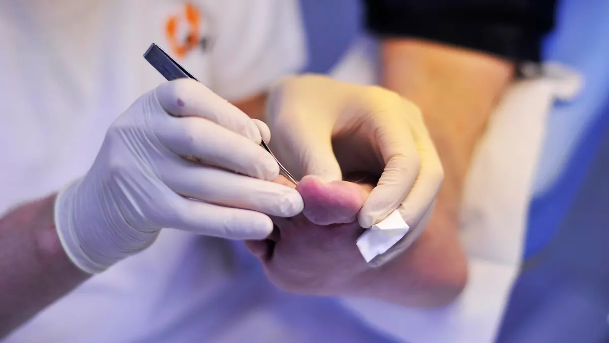 Mehr als nur Fußpflege ist die Arbeit des Podologen in seiner Praxis. Der Spezialist fuer Schuhwerk, Gehen und Laufen wird zu einem wichtigen Helfer des Hausarztes und Orthopaeden, der auch bei Erkrankungen des Fußes und auch des Koerpers, wie z. B. des diabetischen Fußes, eine wichtige Hilfe ist.