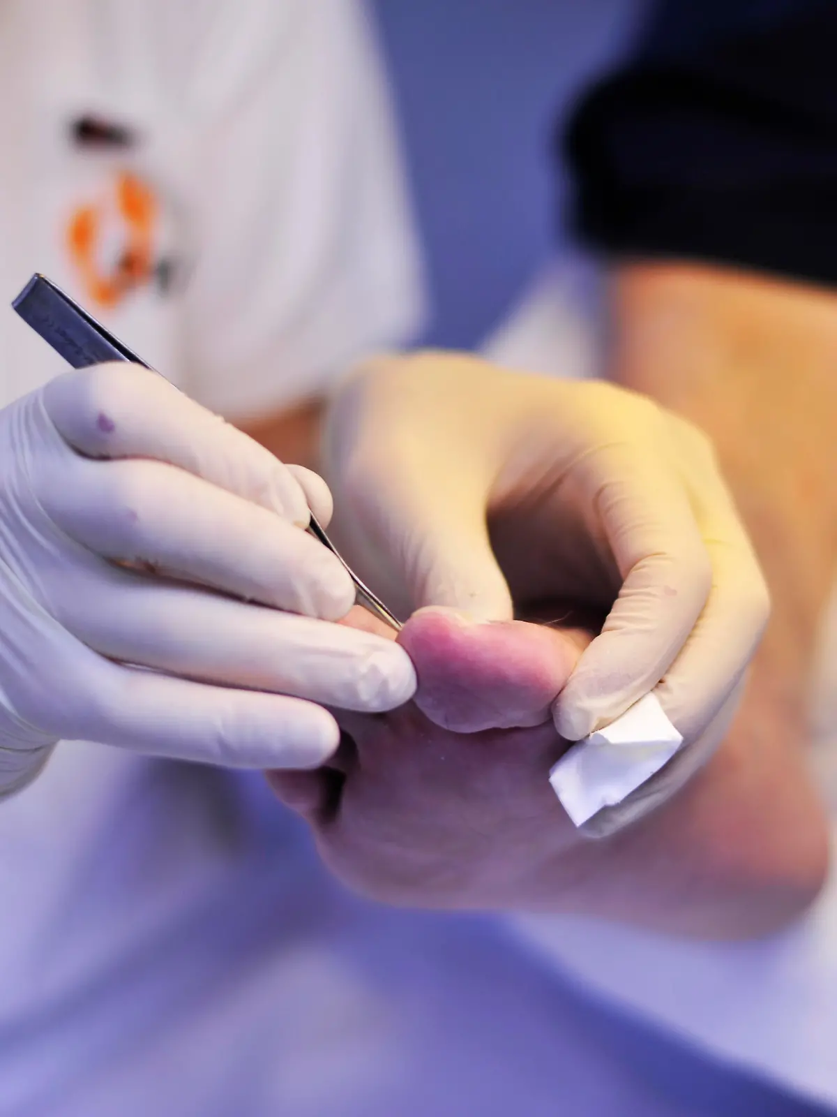 Mehr als nur Fußpflege ist die Arbeit des Podologen in seiner Praxis. Der Spezialist fuer Schuhwerk, Gehen und Laufen wird zu einem wichtigen Helfer des Hausarztes und Orthopaeden, der auch bei Erkrankungen des Fußes und auch des Koerpers, wie z. B. des diabetischen Fußes, eine wichtige Hilfe ist.