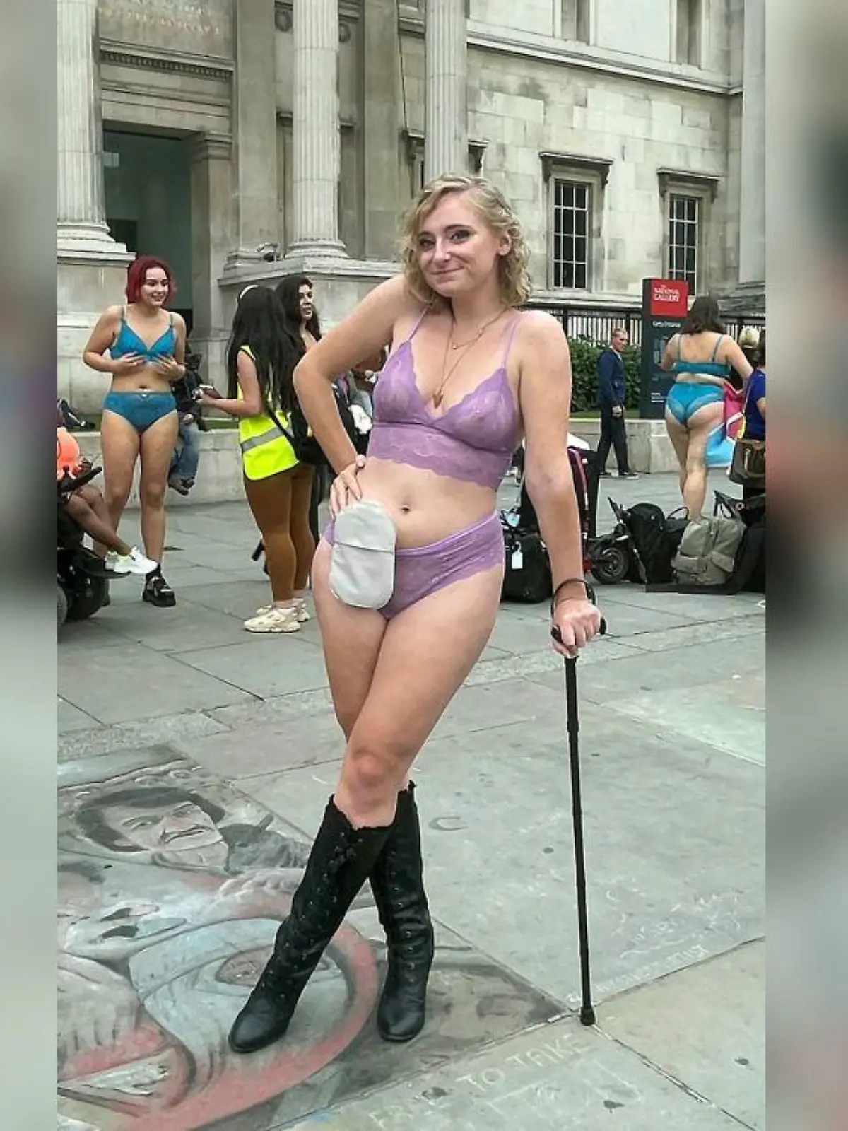 Sie tritt mit dem Stoma auf der Londoner Fashion Week auf