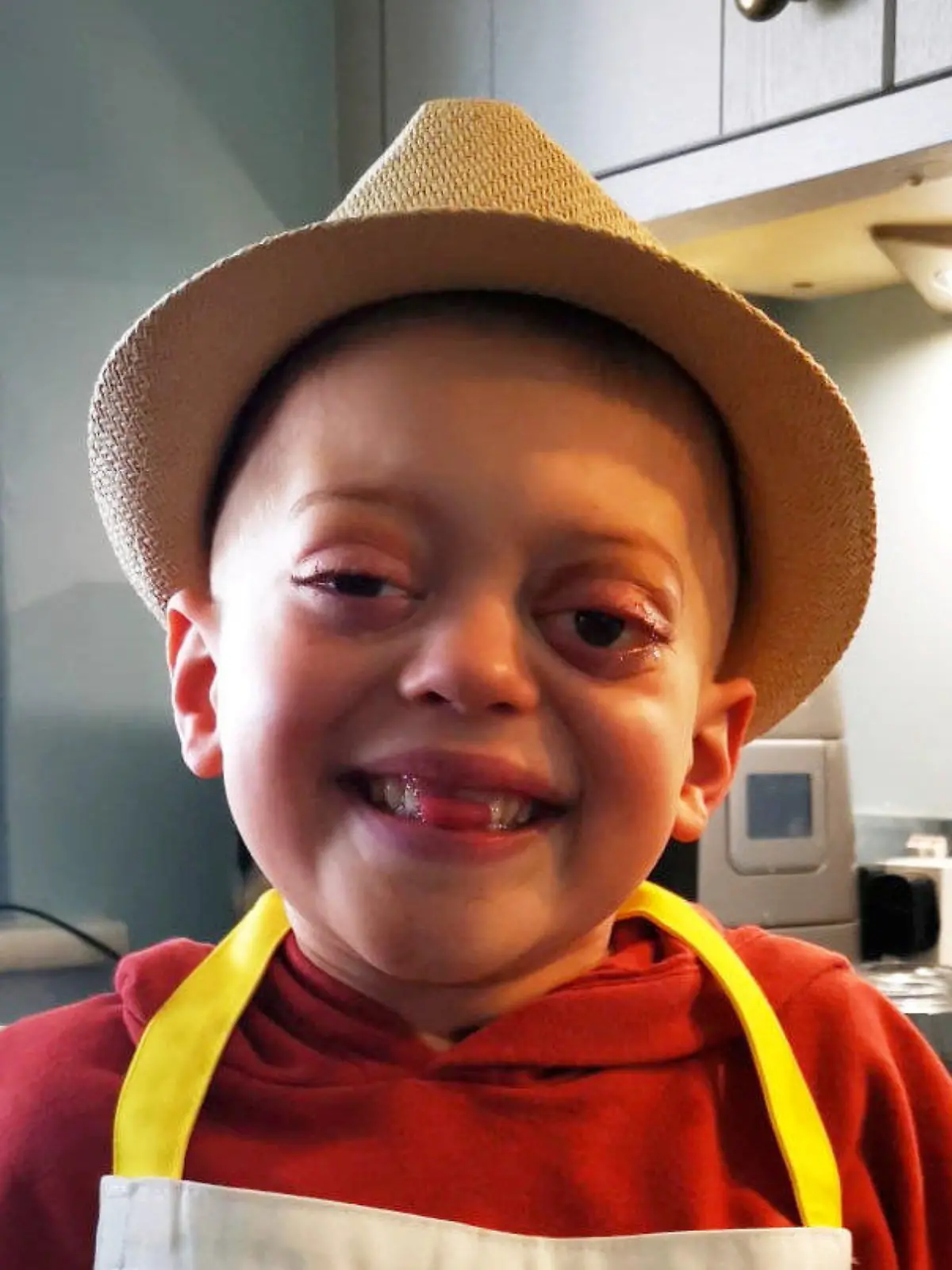SONDERKONDITIONEN: Satzpreis!
Sebastian Nunney in July 2023. See SWNS story SWLScancer. A six-year-old boy is battling a rare cancer after bungling medics dismissed his symptoms as behavioral problems. Sebastian Nunney was diagnosed with a rare type of childhood cancer after going to the hospital with agonising ear ache. His mother Lindsay, was initially told he was suffering from an ear infection or his distress could be due to his behavior. Doctors finally discovered a mass in his /// weeks later and a series of tests revealed it was actually neuroblastoma. / action press