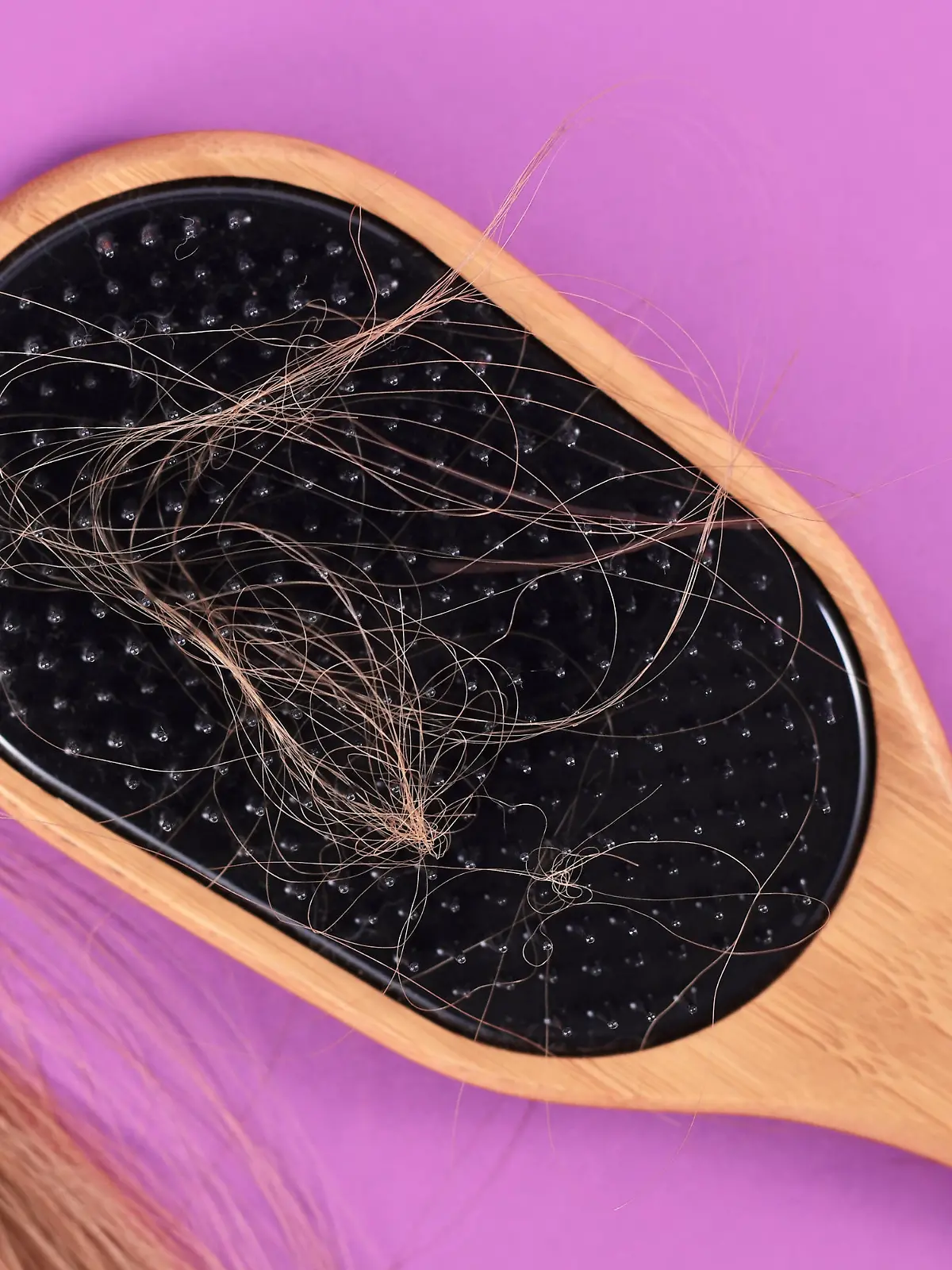 Concept for losing hair with strands of blond hair caught in hair brush