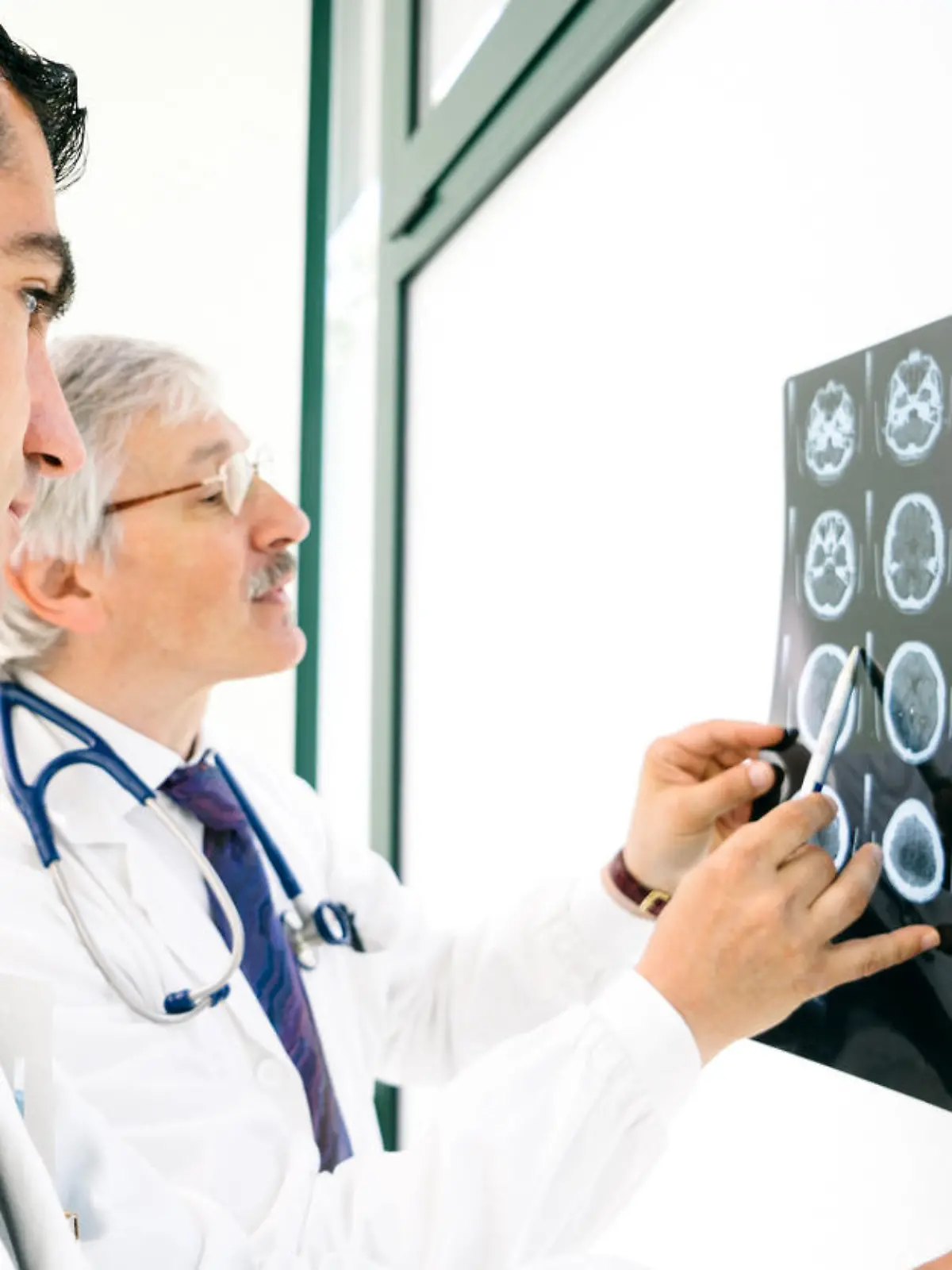 Doctors consult over an MRI scan of the brain.