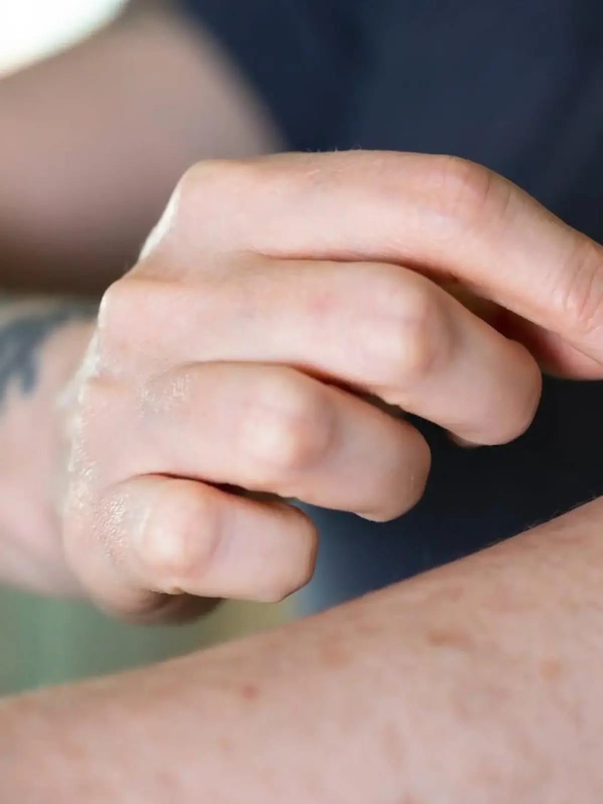 Können wir uns schon bald selbst Tattoos stechen? Eine Tattoo-Pflaster-Sensation könnte das bald ermöglichen.