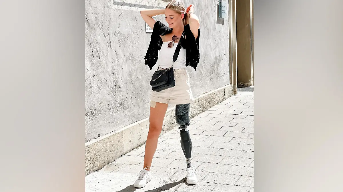 Anna Osicki (25) und ihre Beinprothese.