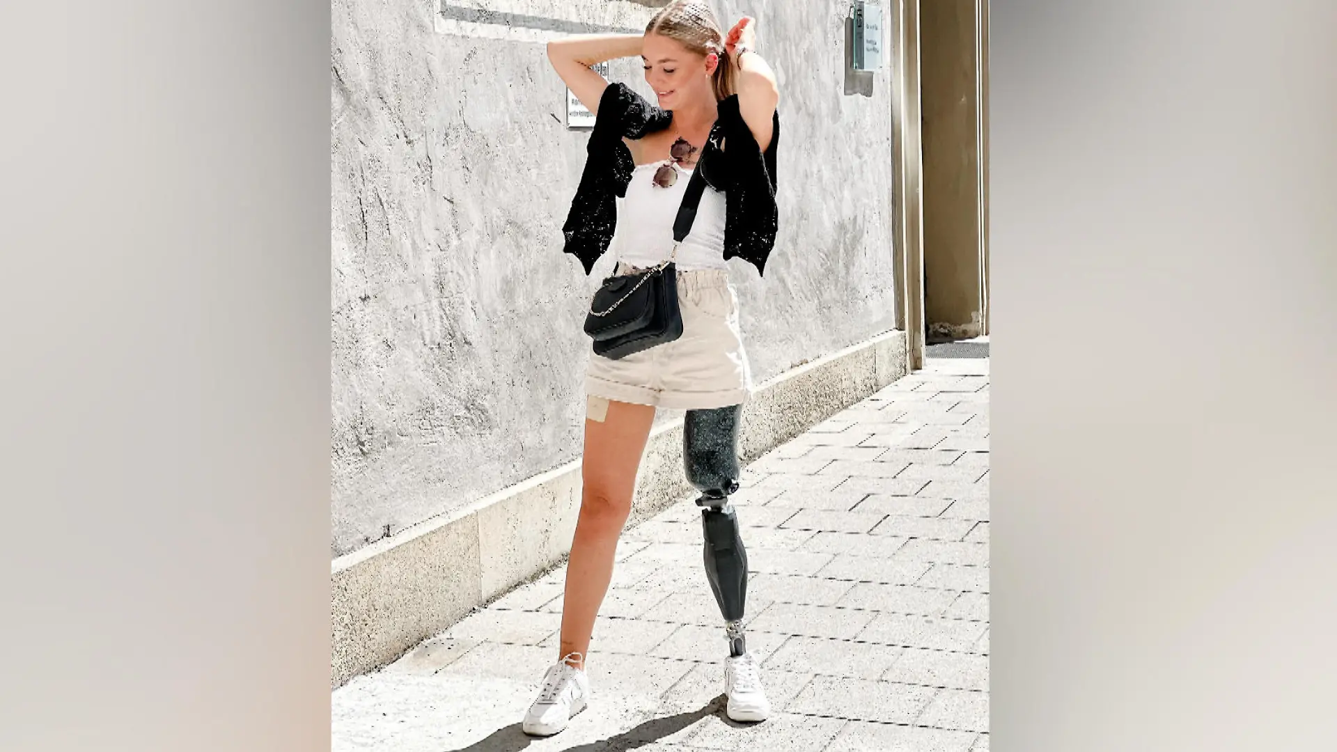 Anna Osicki (25) und ihre Beinprothese.